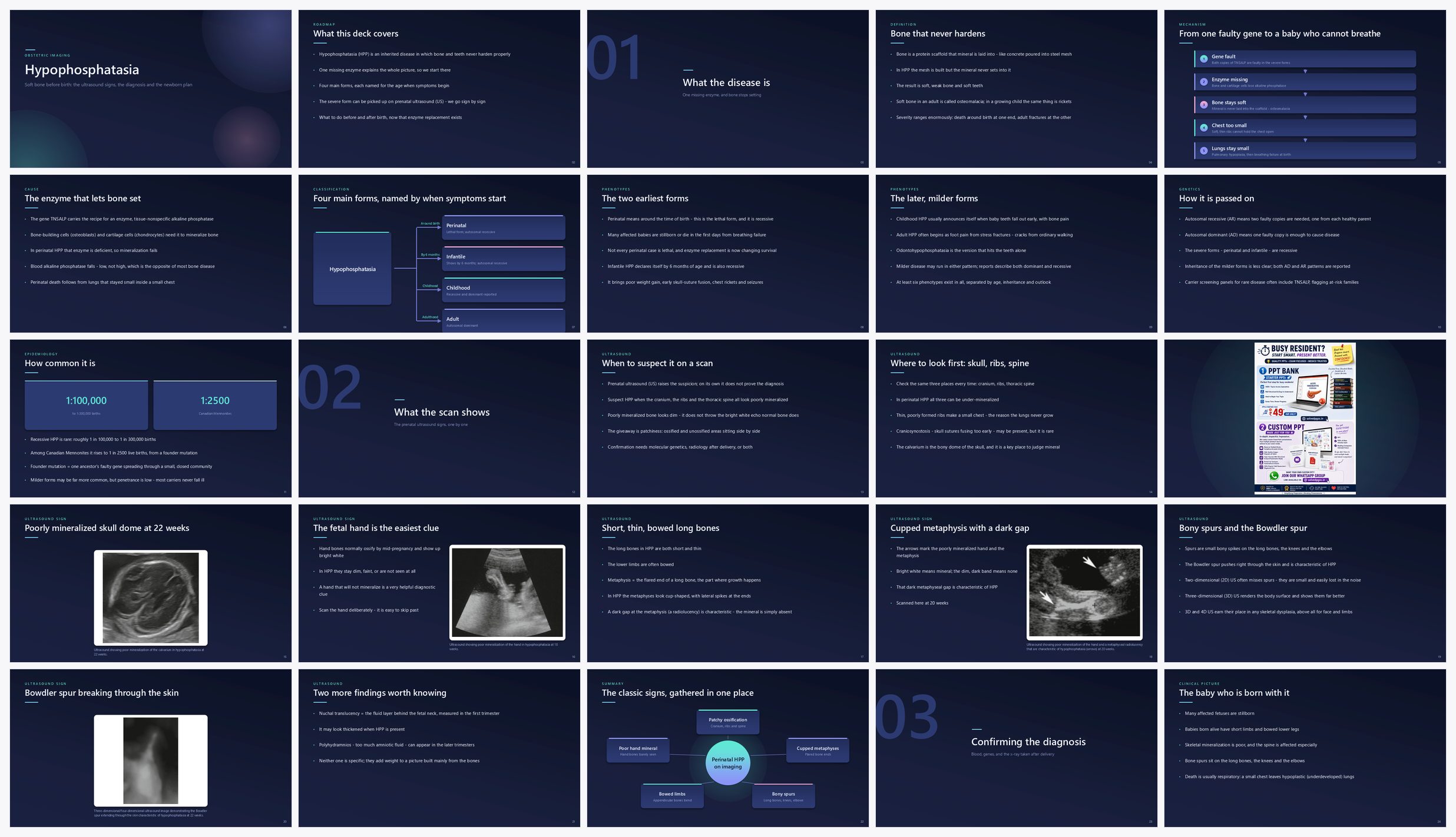 Preview of the first 25 slides of Hypophosphatasia