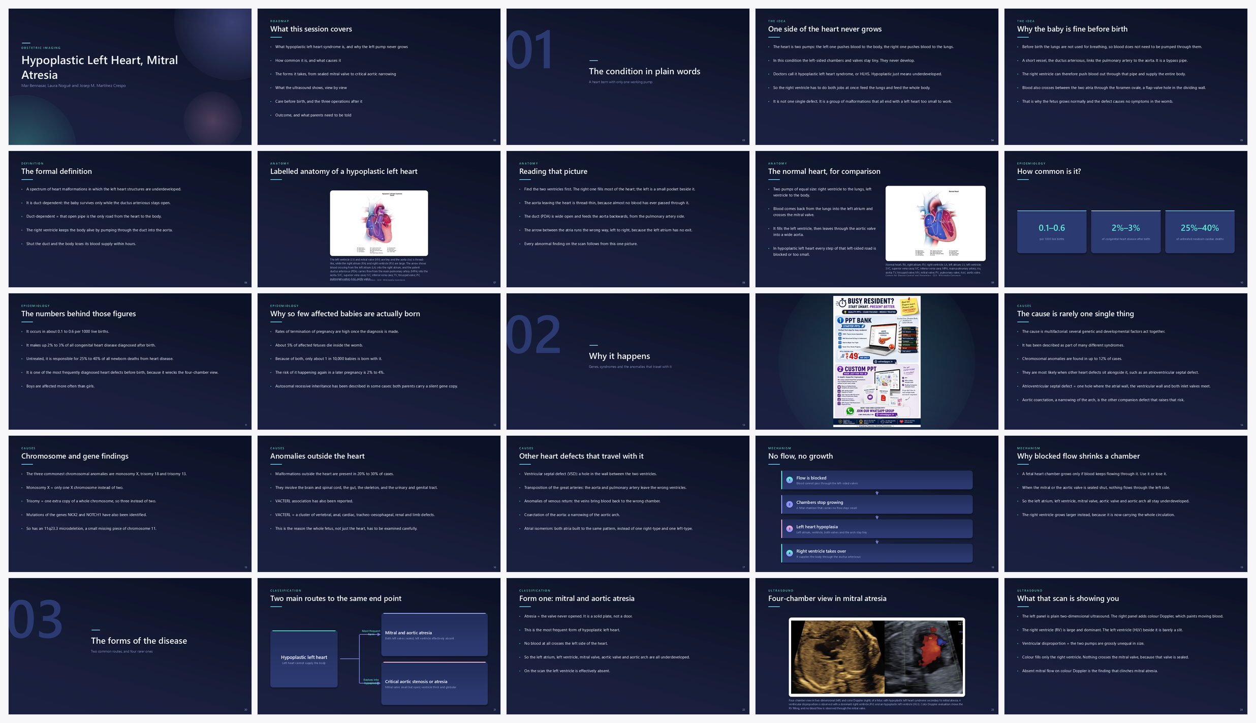 Preview of the first 25 slides of Hypoplastic Left Heart, Mitral Atresia