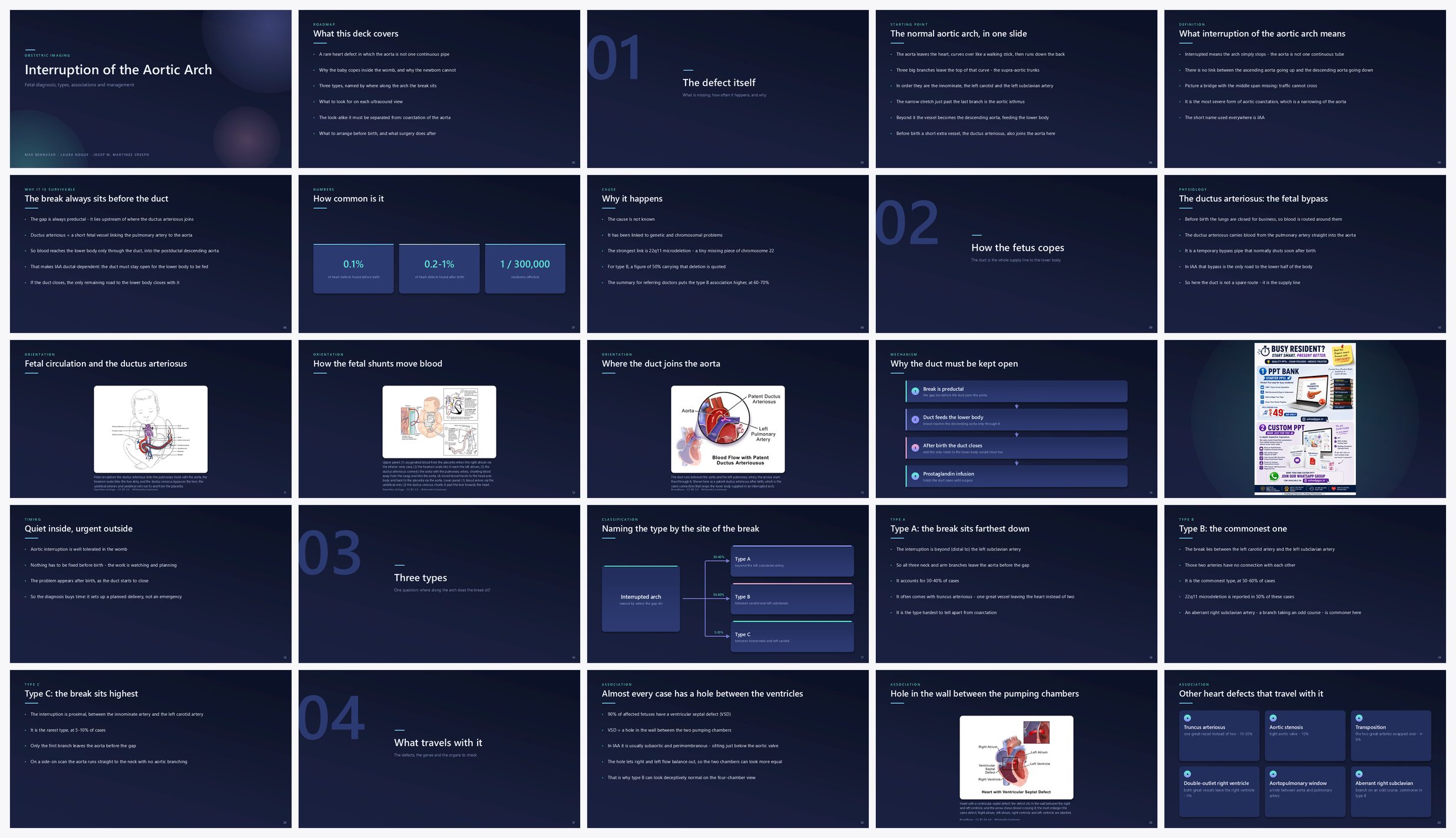 Preview of the first 25 slides of Interruption of the Aortic Arch