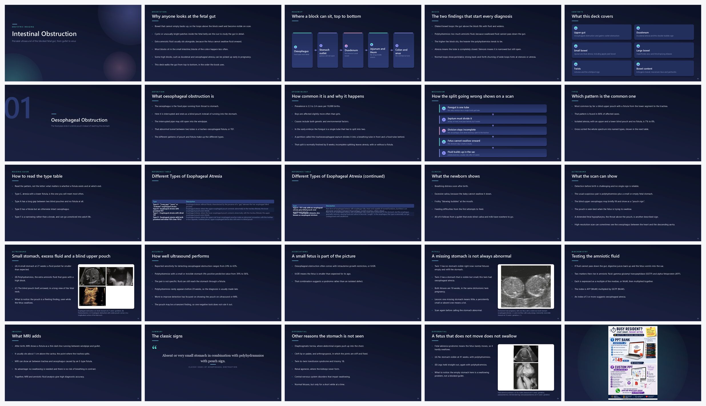 Preview of the first 25 slides of Intestinal Obstruction