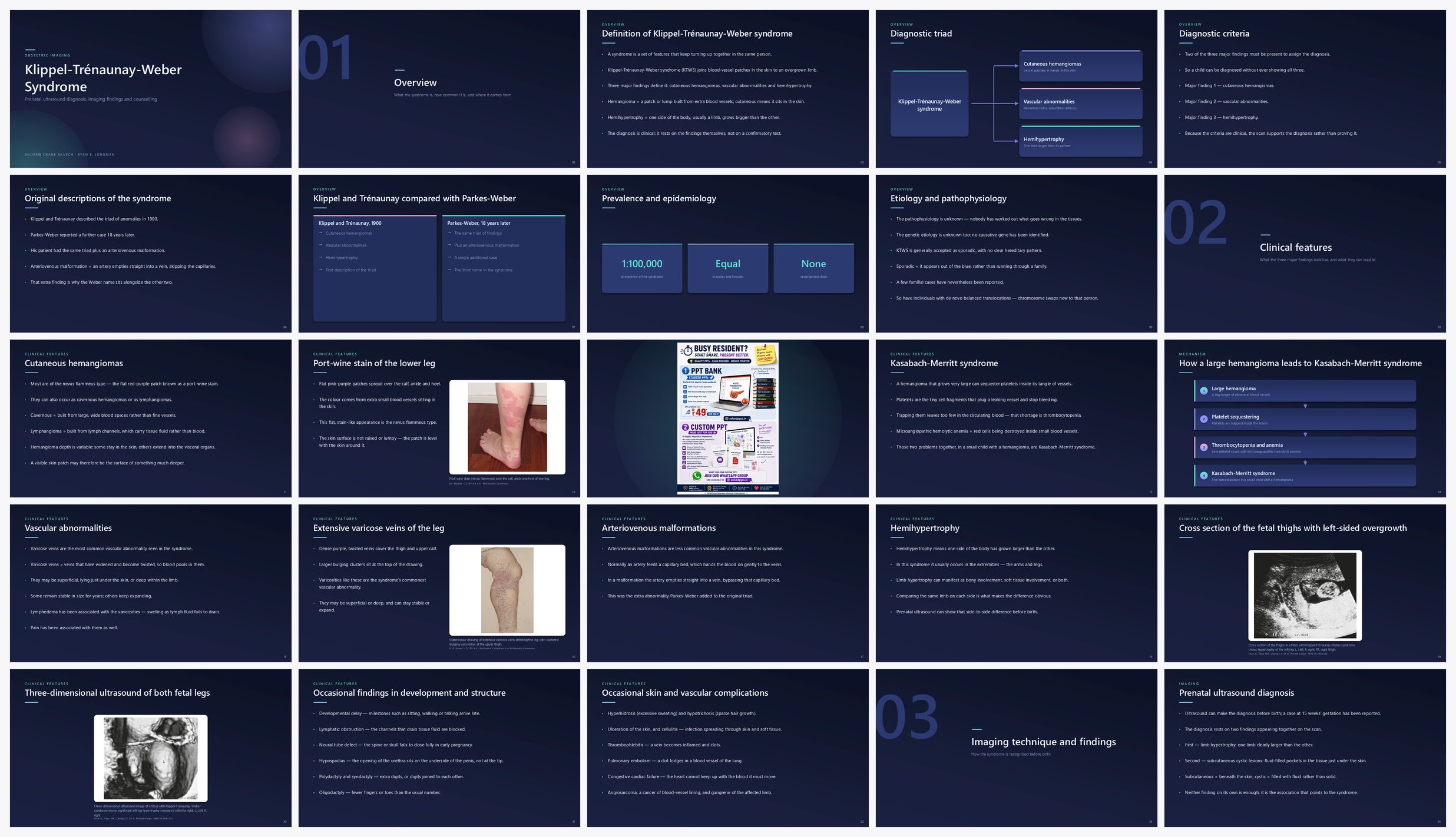 Preview of the first 25 slides of Klippel-Trénaunay-Weber Syndrome