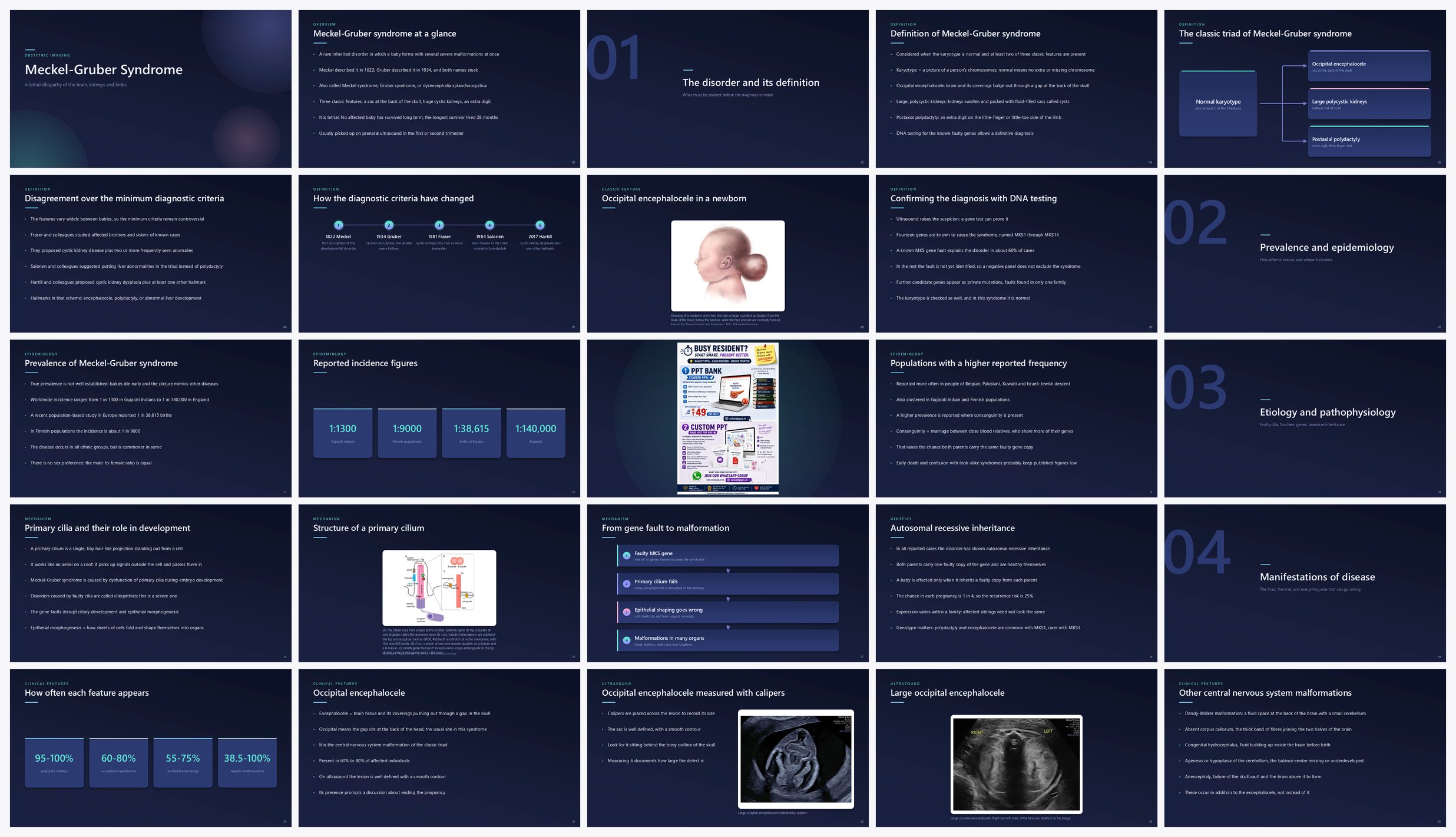 Preview of the first 25 slides of Meckel-Gruber Syndrome