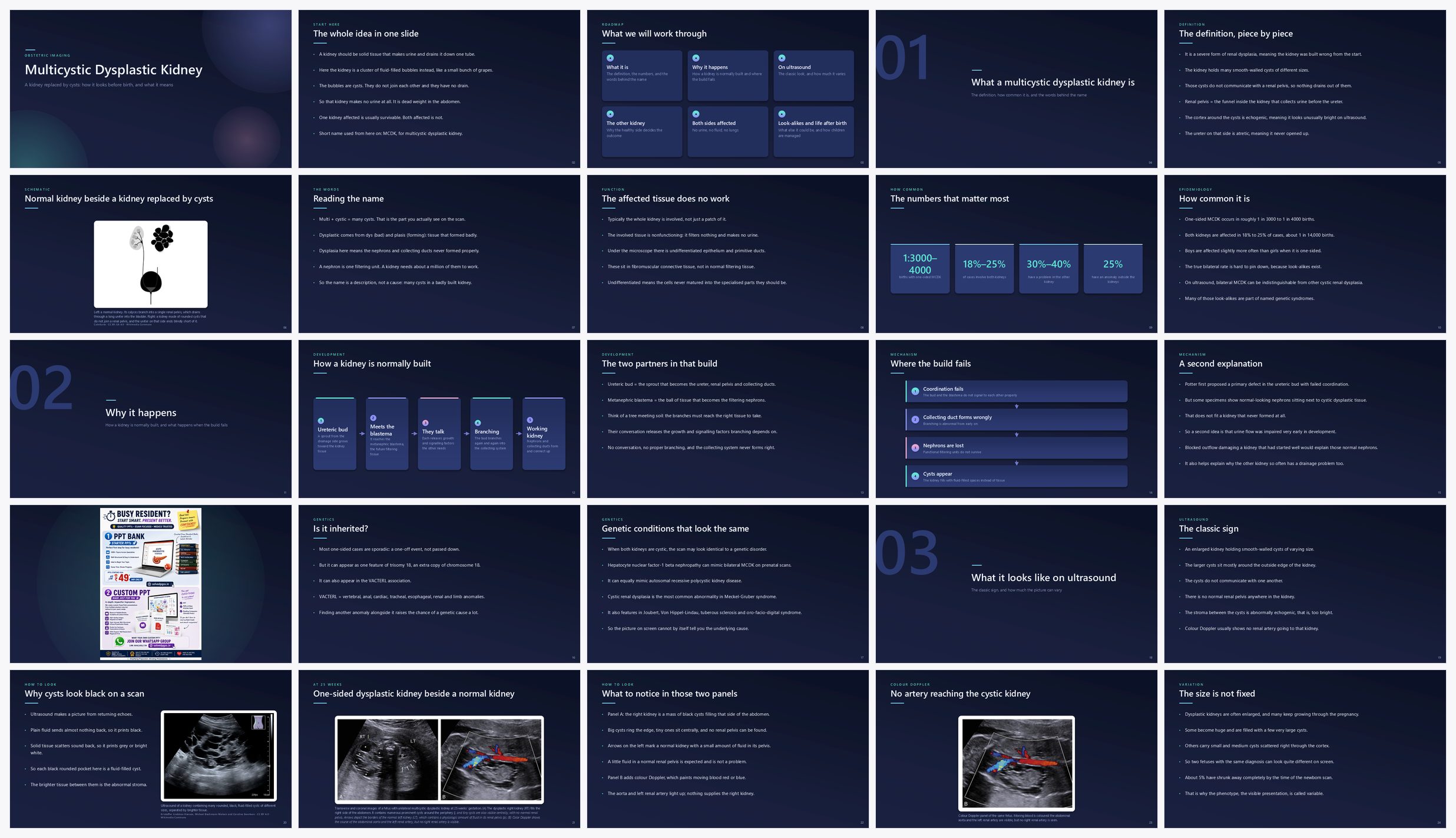 Preview of the first 25 slides of Multicystic Dysplastic Kidney