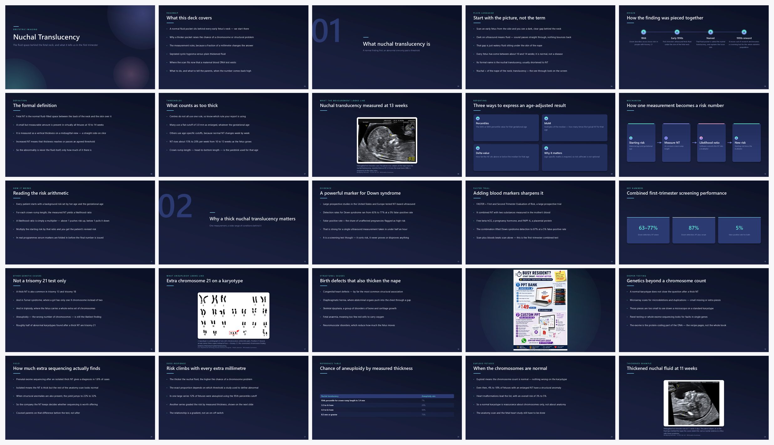 Preview of the first 25 slides of Nuchal Translucency