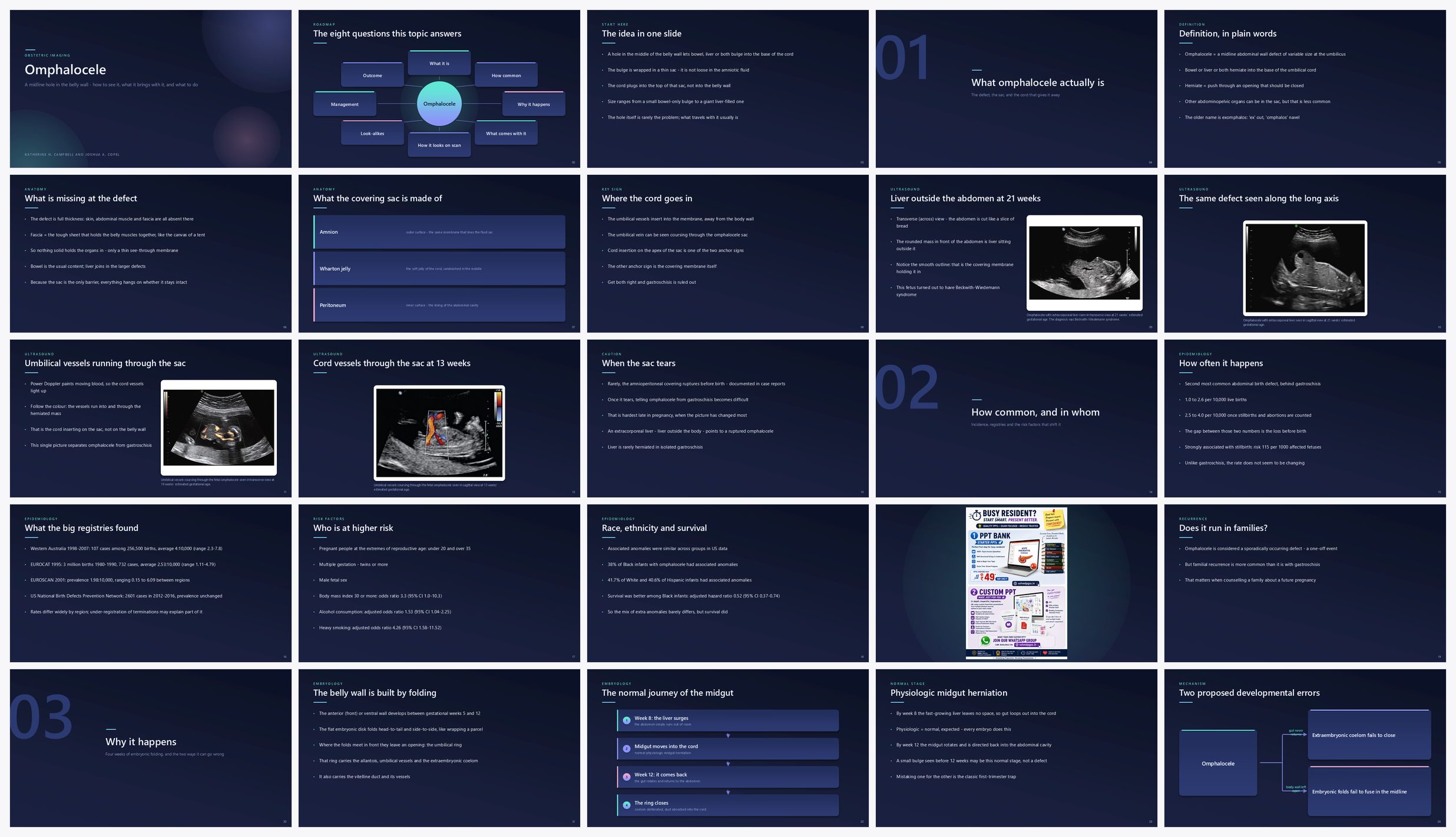 Preview of the first 25 slides of Omphalocele