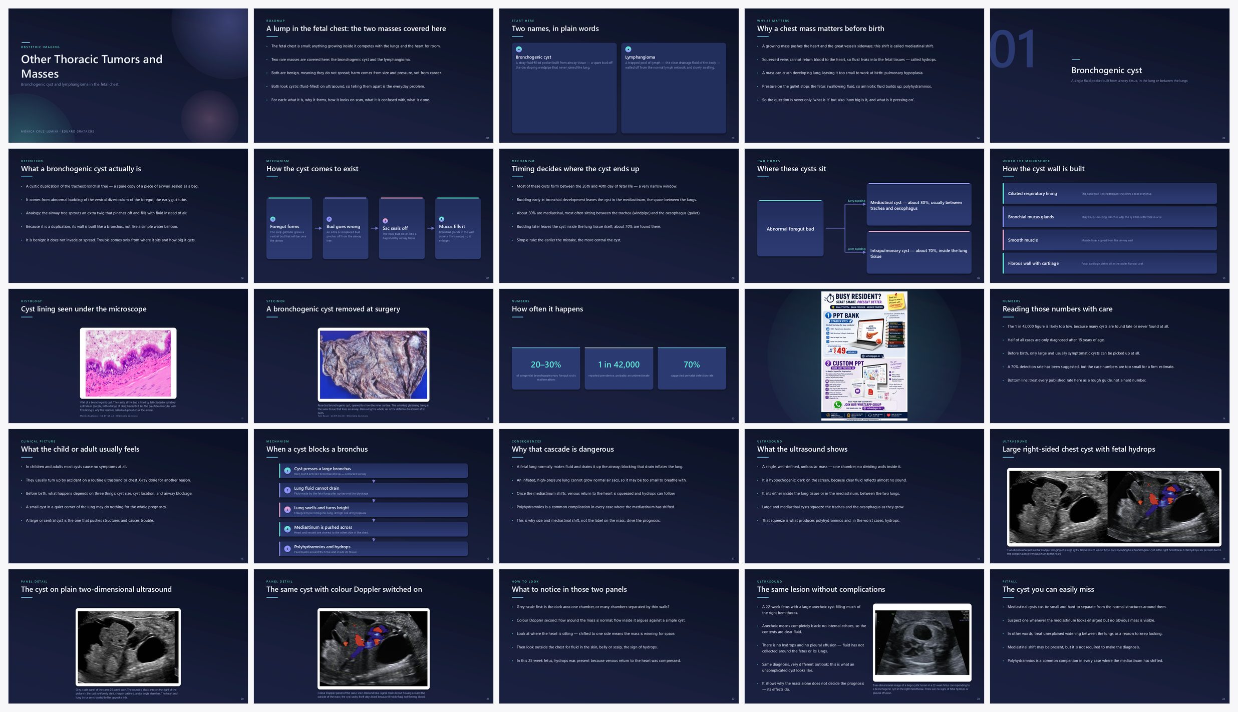 Preview of the first 25 slides of Other Thoracic Tumors and Masses