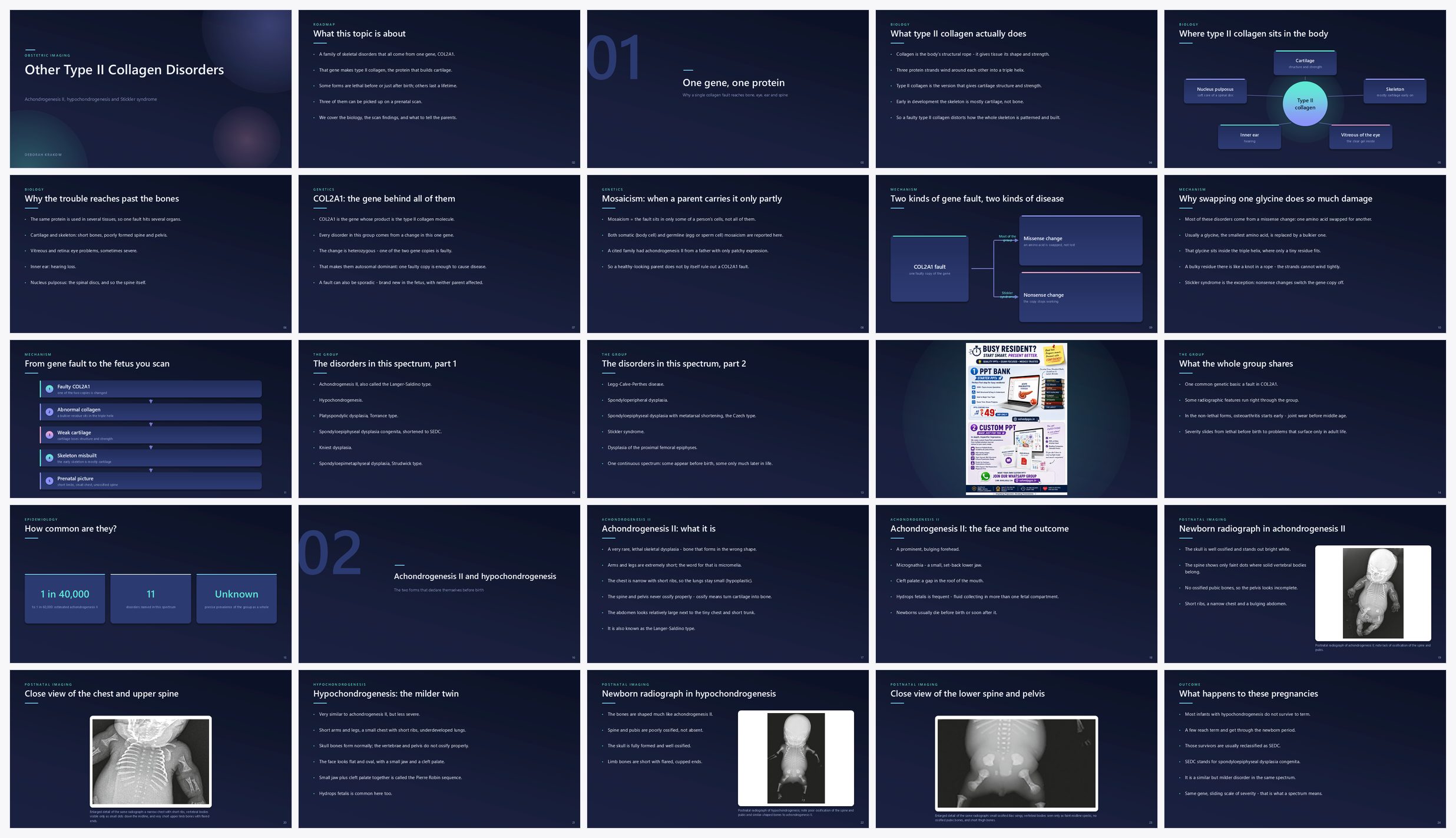 Preview of the first 25 slides of Other Type II Collagen Disorders