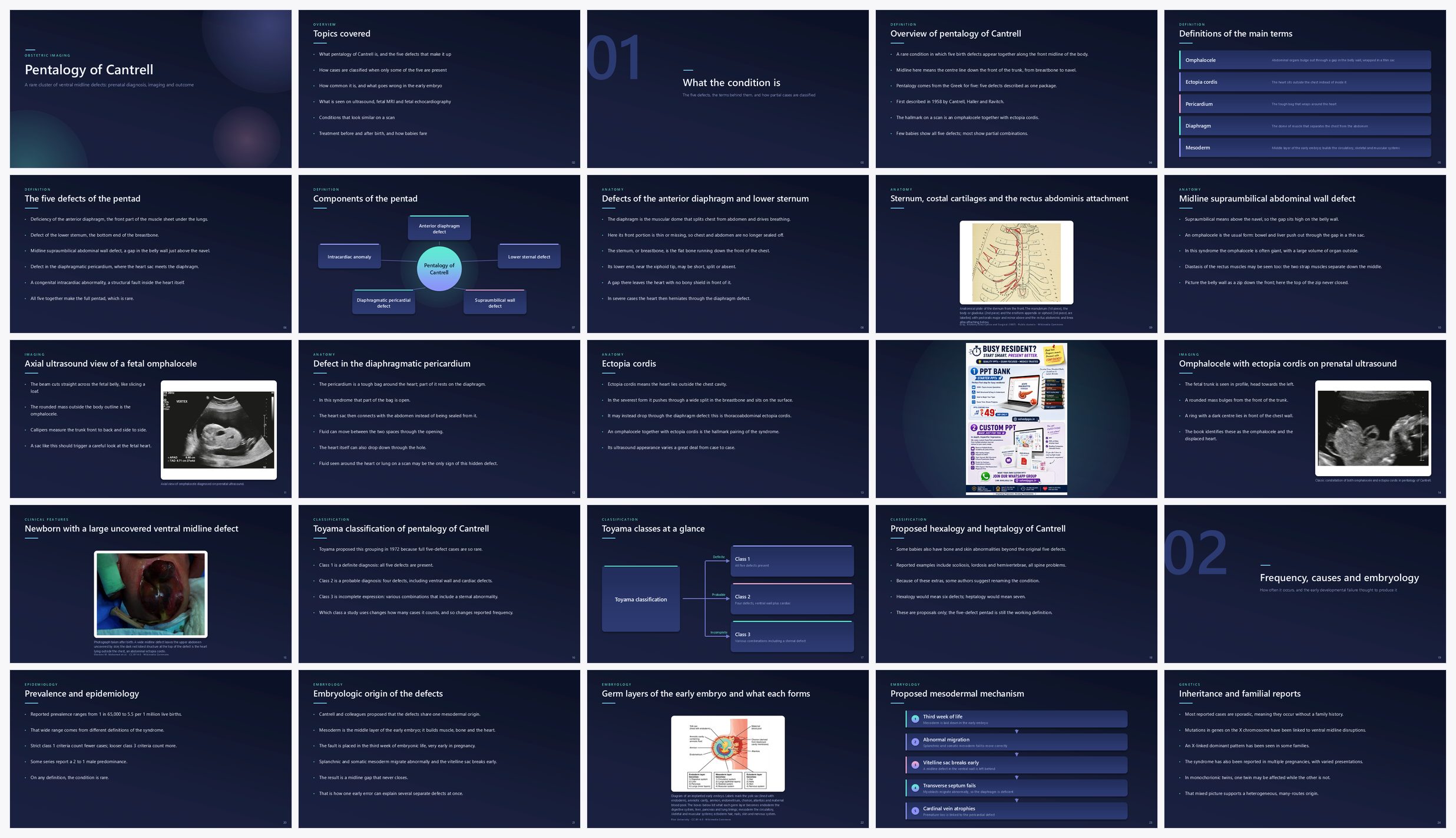 Preview of the first 25 slides of Pentalogy of Cantrell