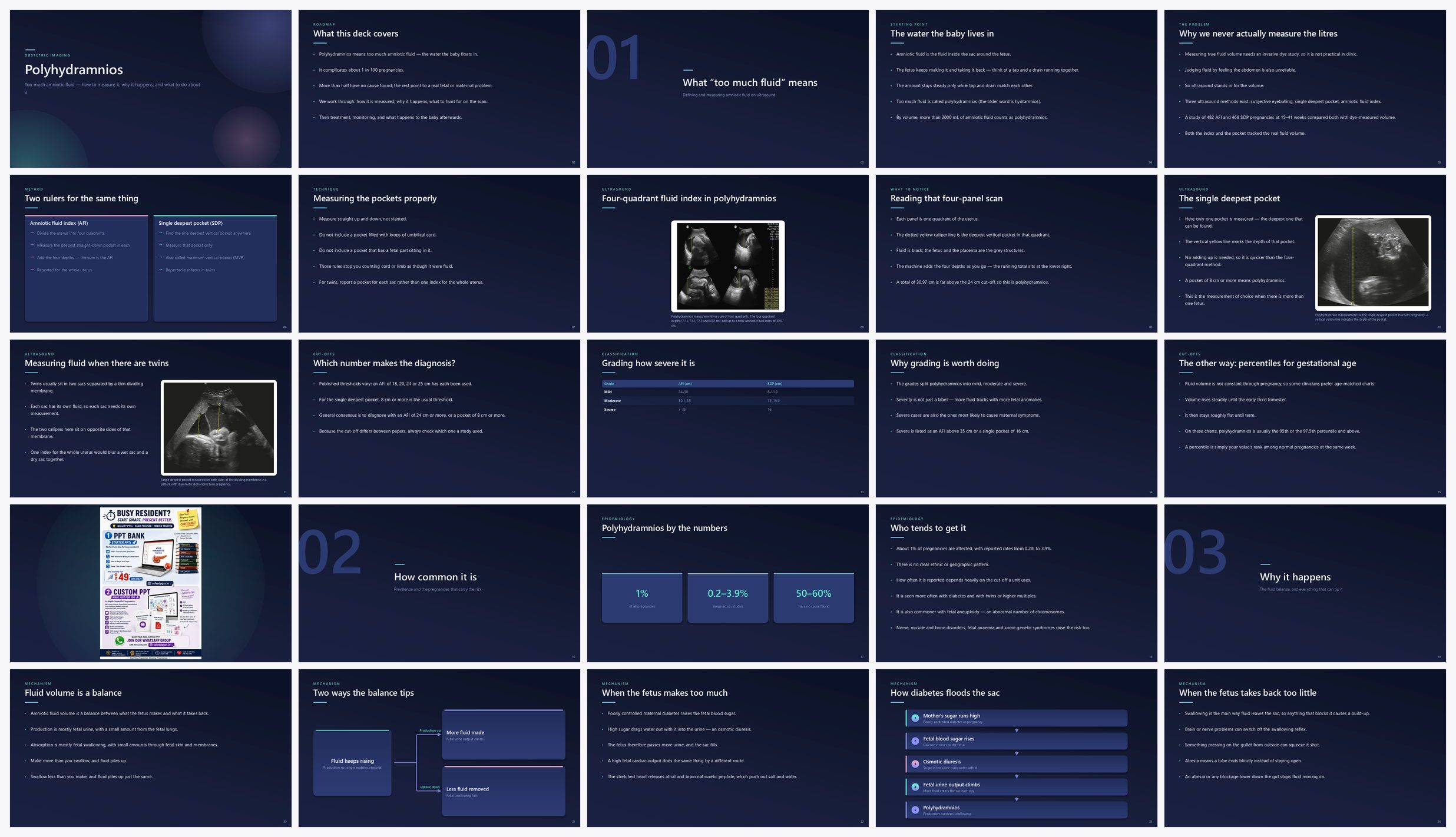 Preview of the first 25 slides of Polyhydramnios