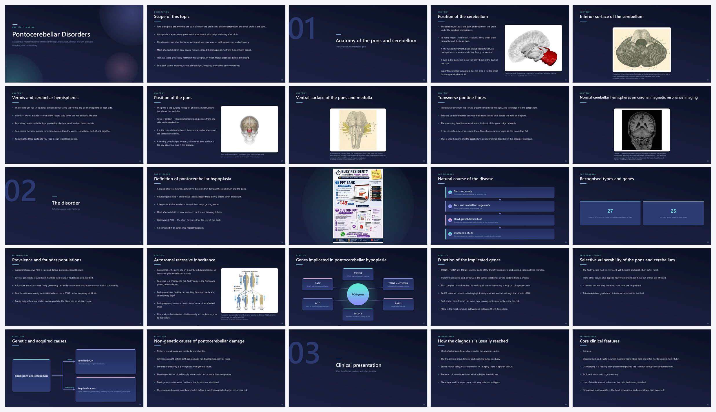 Preview of the first 25 slides of Pontocerebellar Disorders
