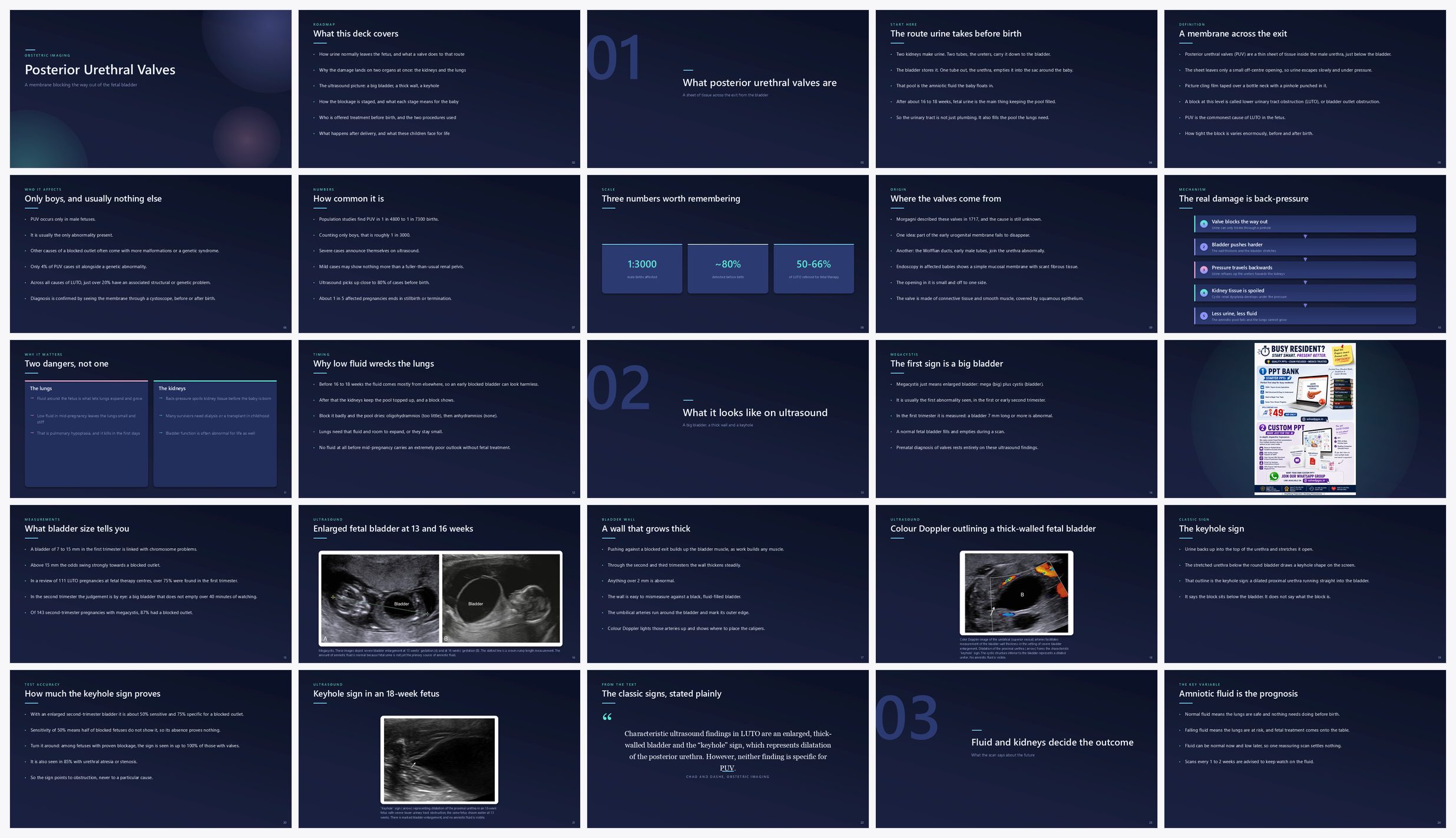 Preview of the first 25 slides of Posterior Urethral Valves