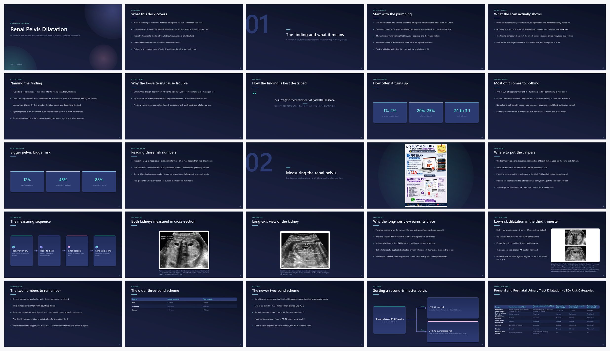 Preview of the first 25 slides of Renal Pelvis Dilatation