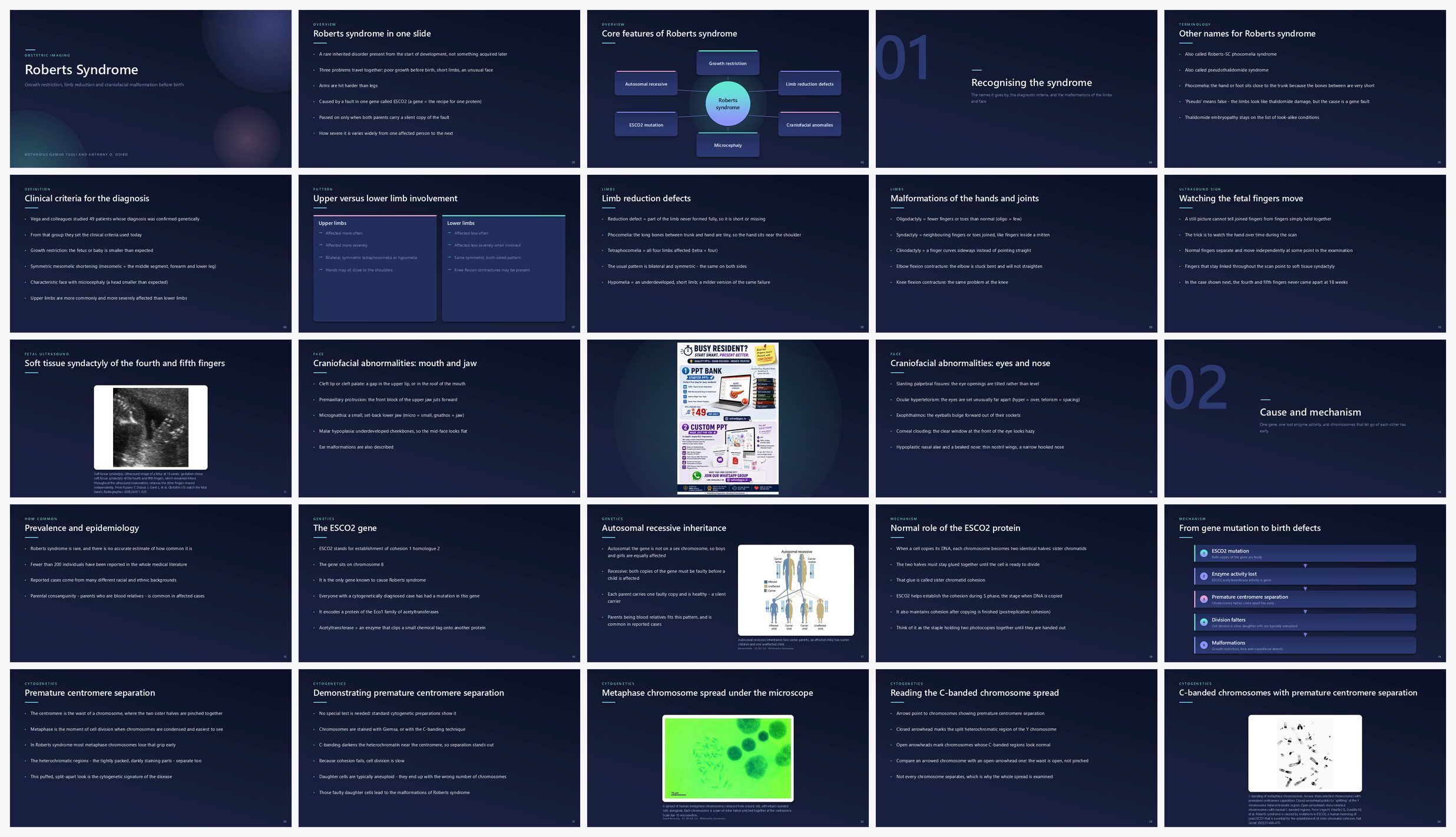 Preview of the first 25 slides of Roberts Syndrome