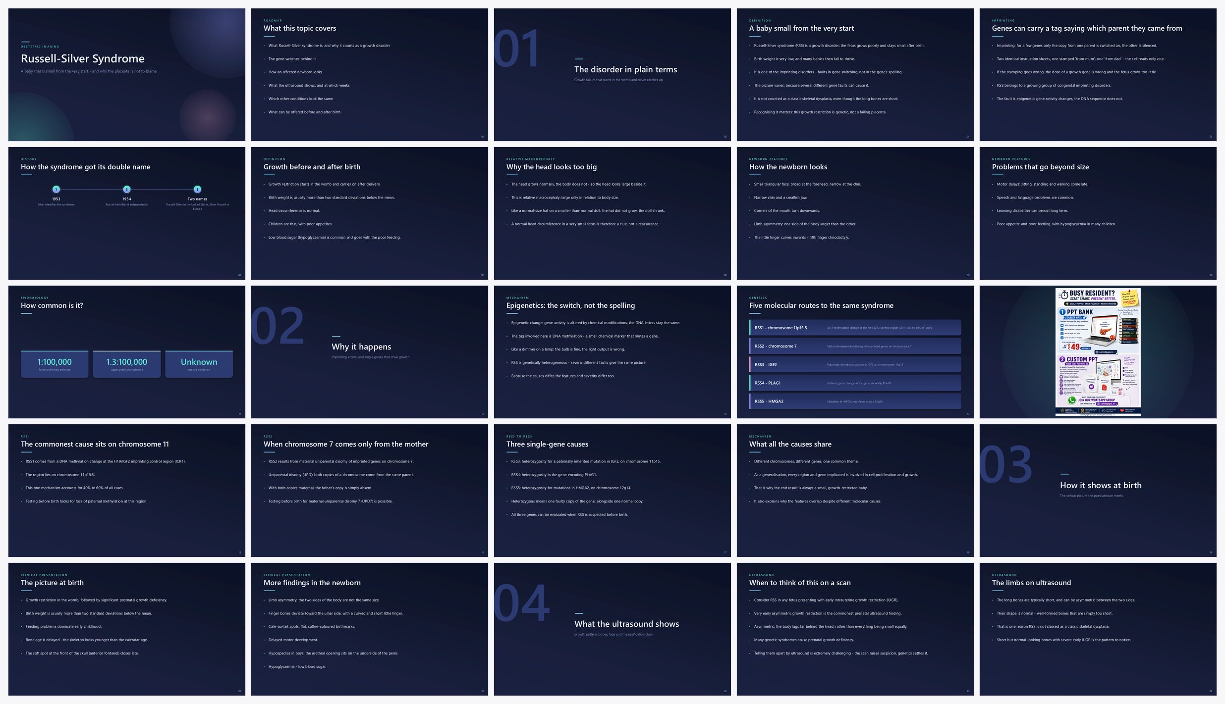Preview of the first 25 slides of Russell-Silver Syndrome