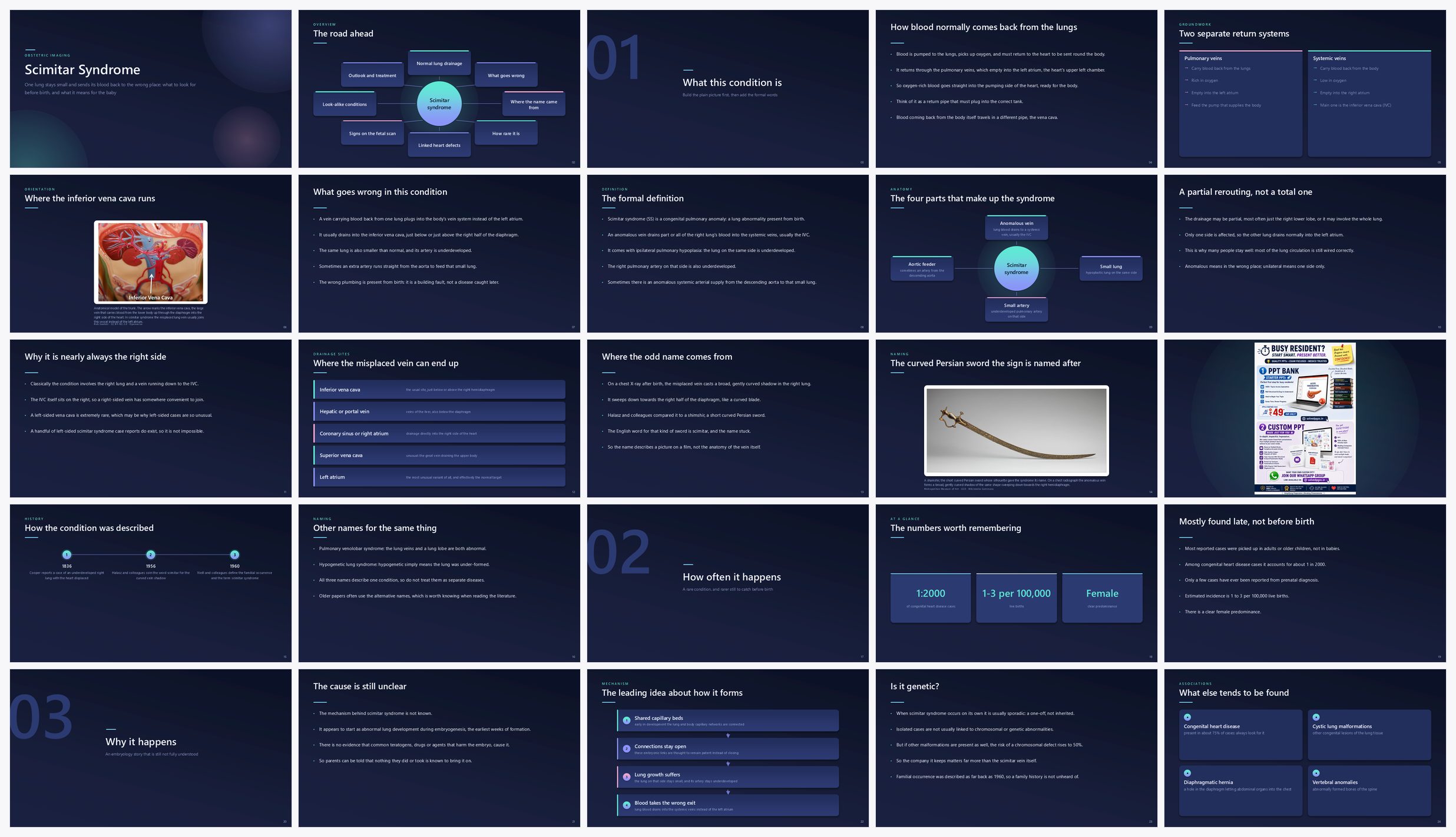 Preview of the first 25 slides of Scimitar Syndrome