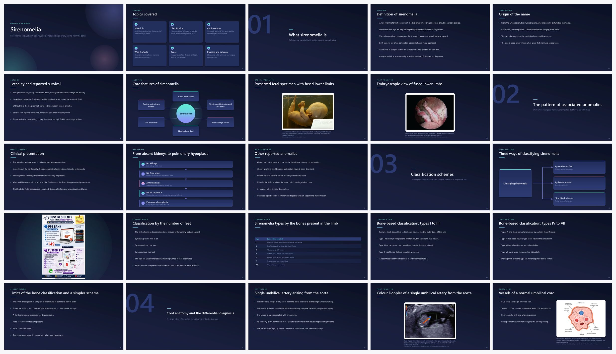 Preview of the first 25 slides of Sirenomelia