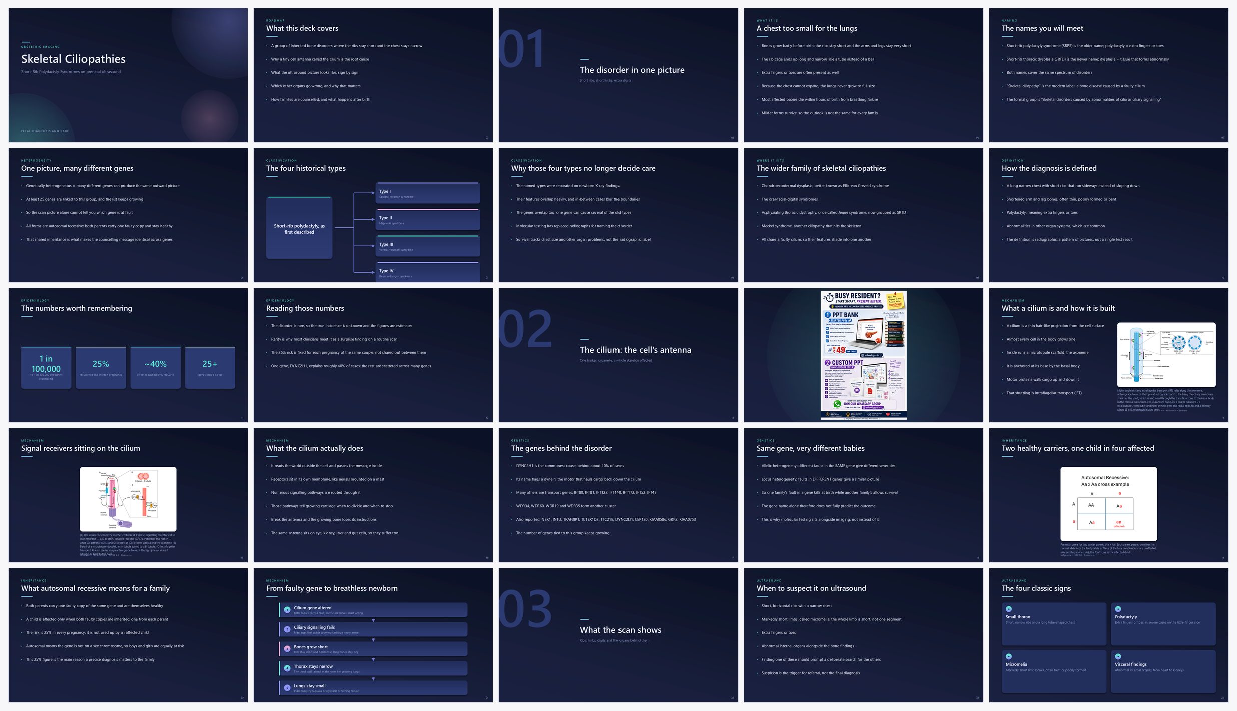 Preview of the first 25 slides of Skeletal Ciliopathies (Short-Rib Polydactyly Syndromes)