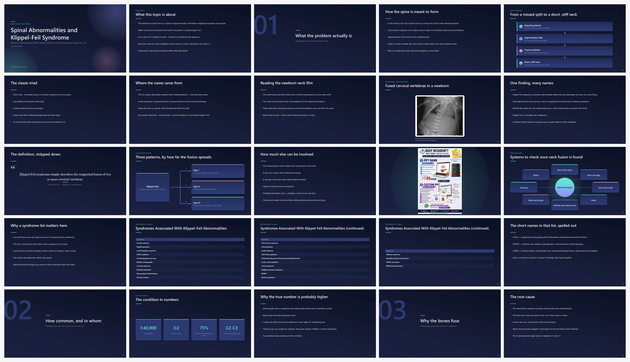Preview of the first 25 slides of Spinal Abnormalities and Klippel-Feil Syndrome
