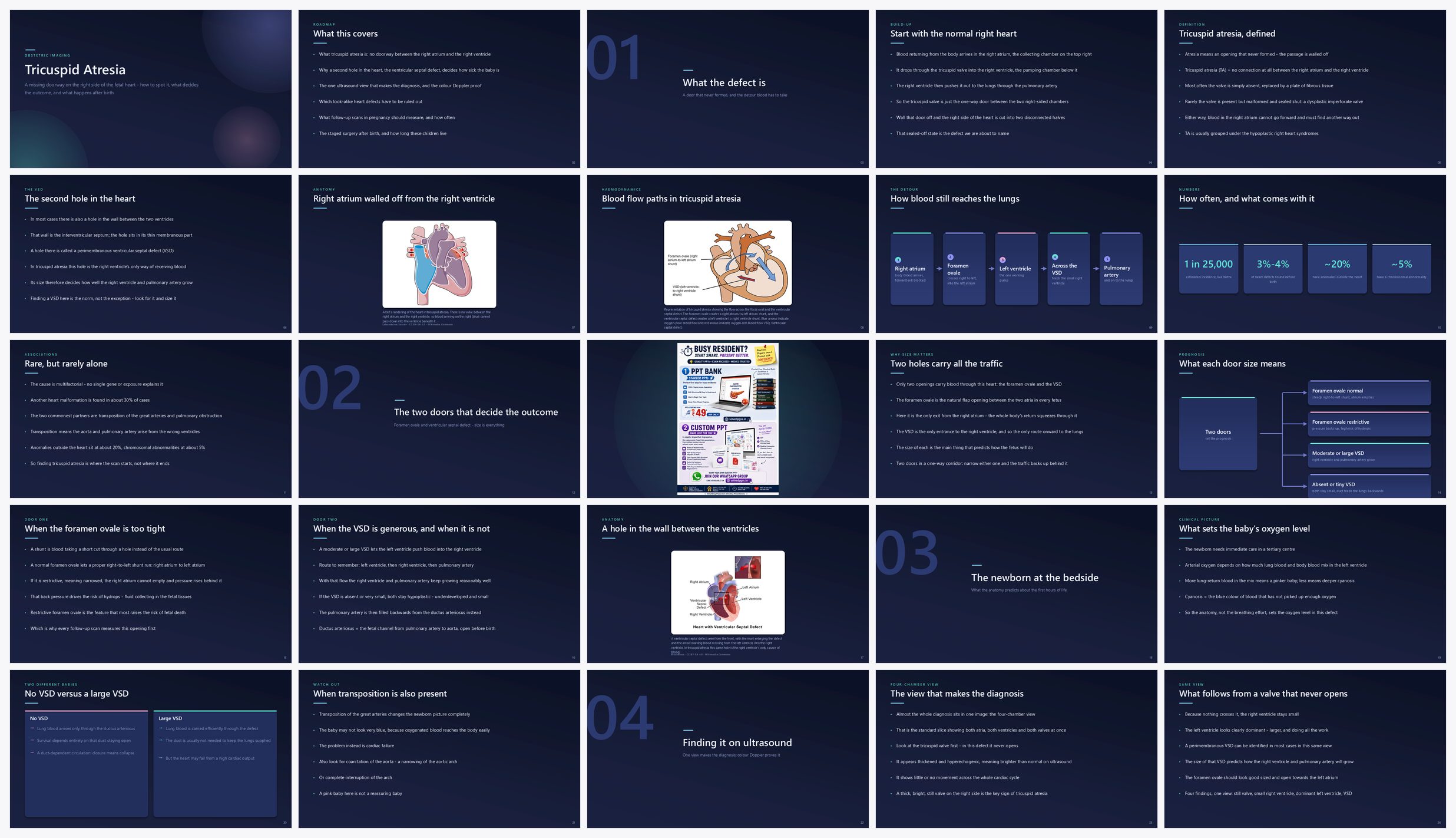 Preview of the first 25 slides of Tricuspid Atresia