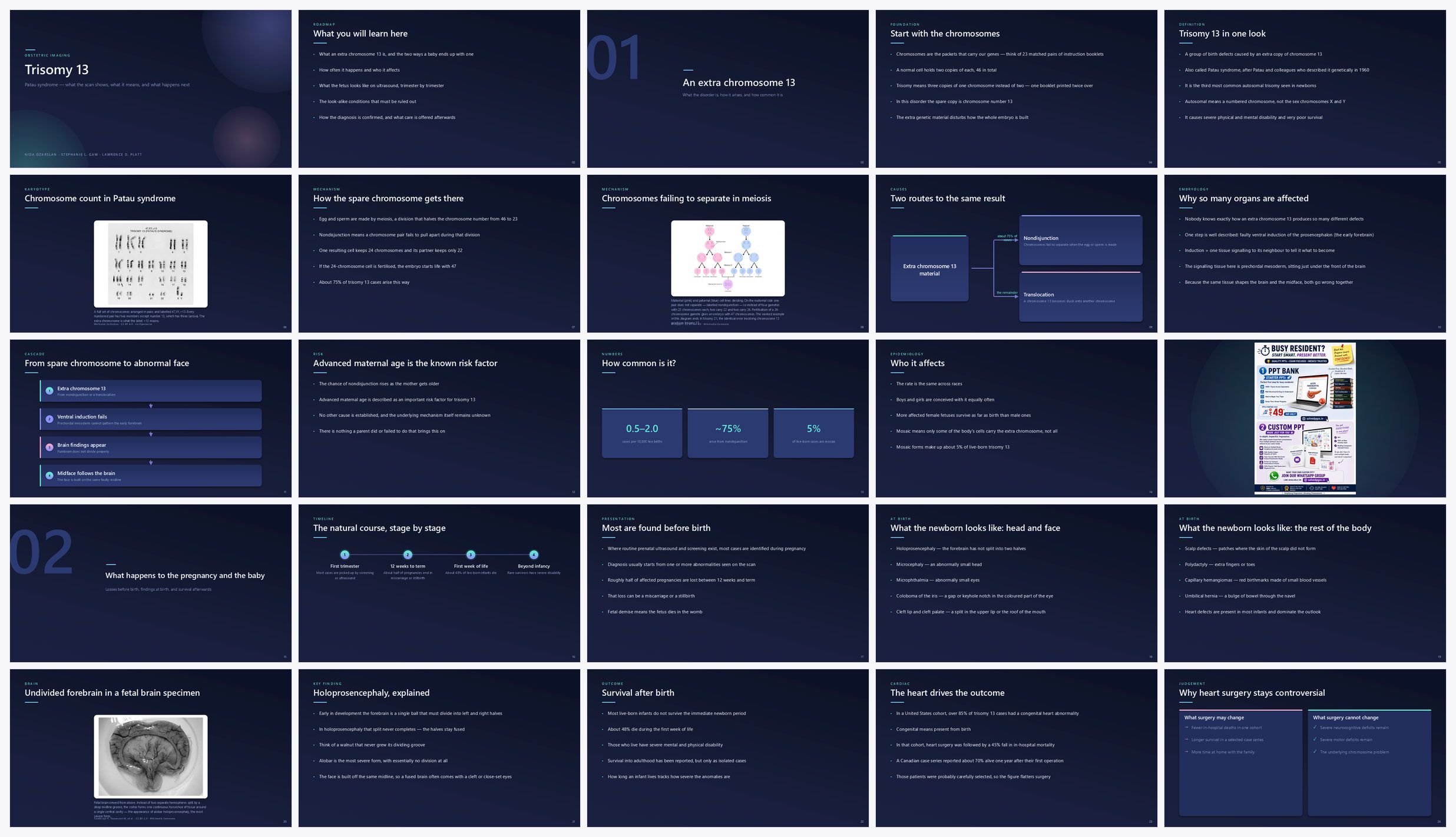 Preview of the first 25 slides of Trisomy 13