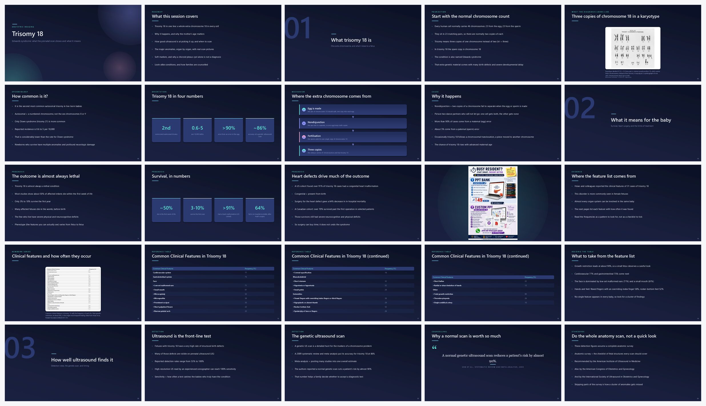 Preview of the first 25 slides of Trisomy 18