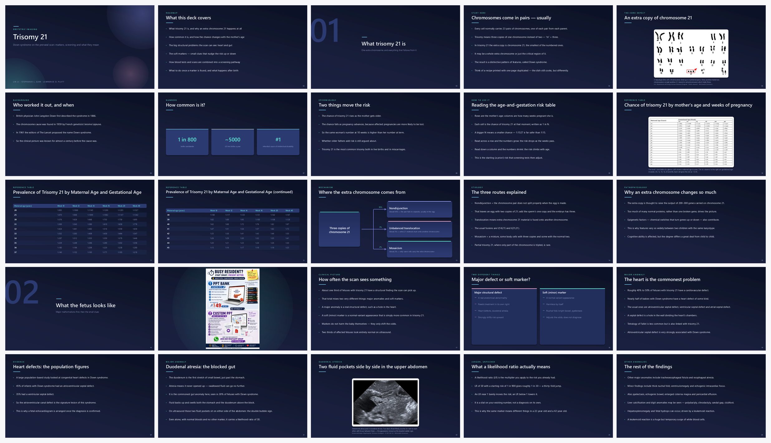 Preview of the first 25 slides of Trisomy 21