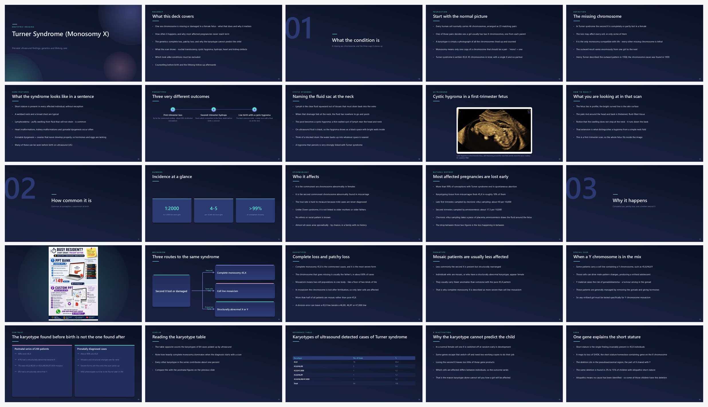 Preview of the first 25 slides of Turner Syndrome (Monosomy X)