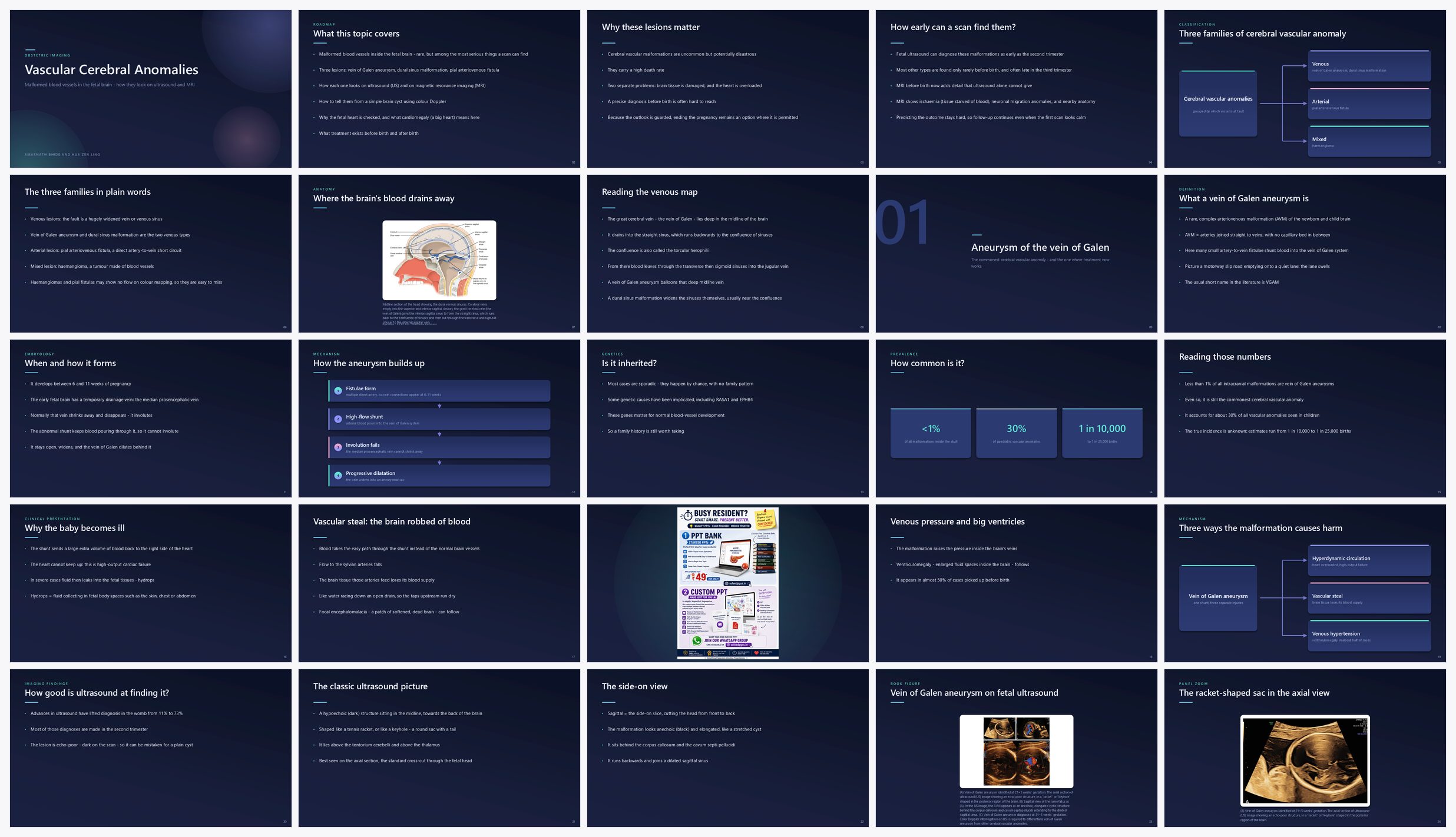 Preview of the first 25 slides of Vascular Cerebral Anomalies