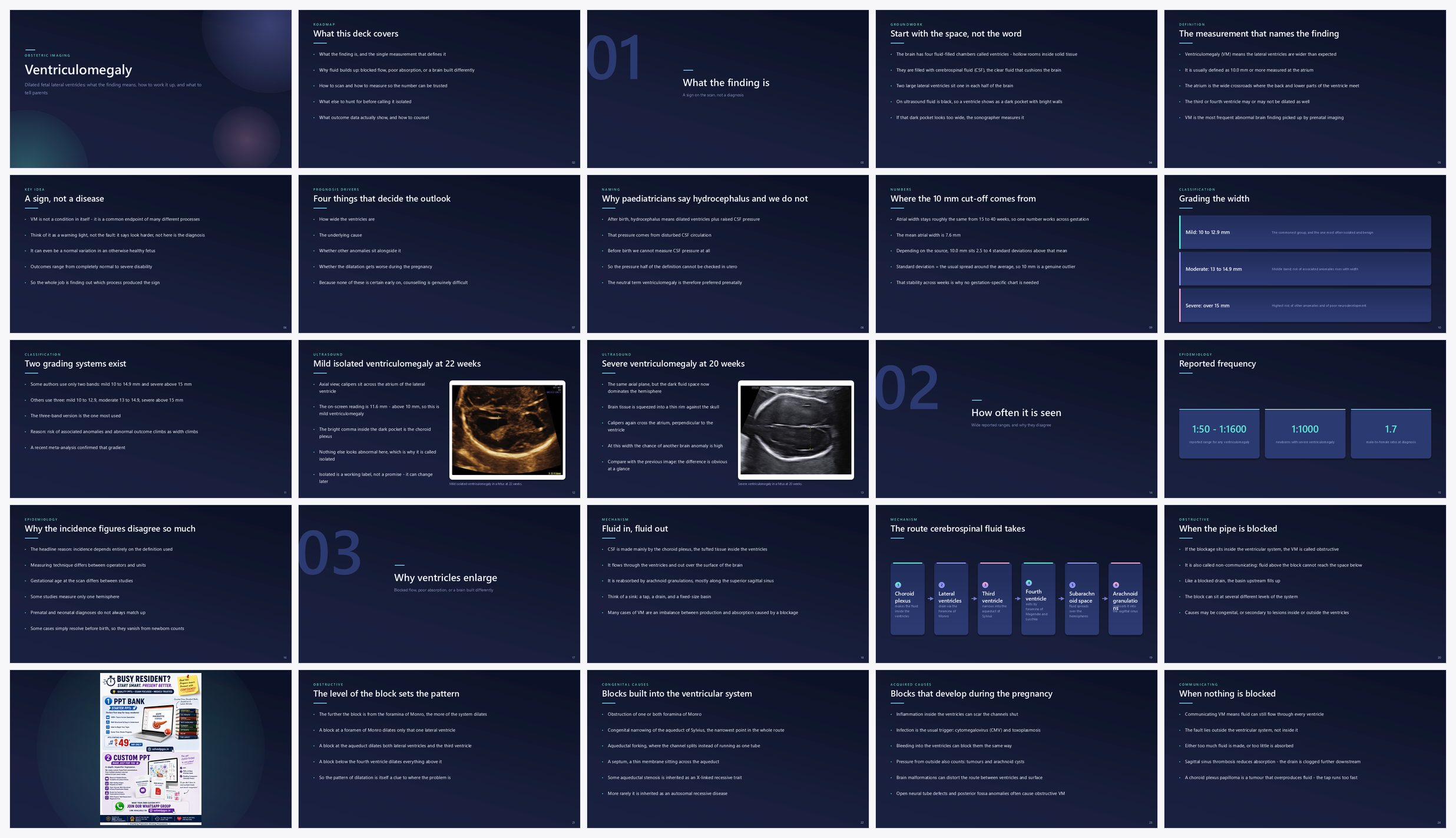 Preview of the first 25 slides of Ventriculomegaly