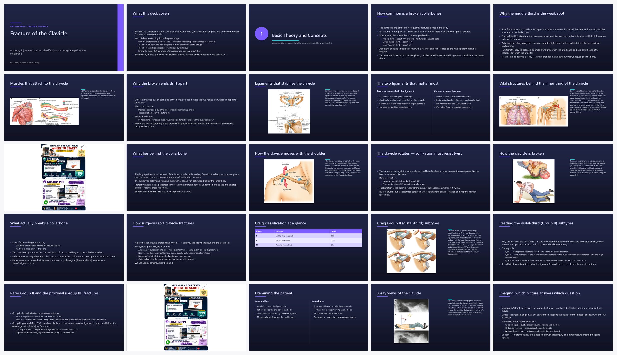 Preview of the first 25 slides of Fracture of the Clavicle