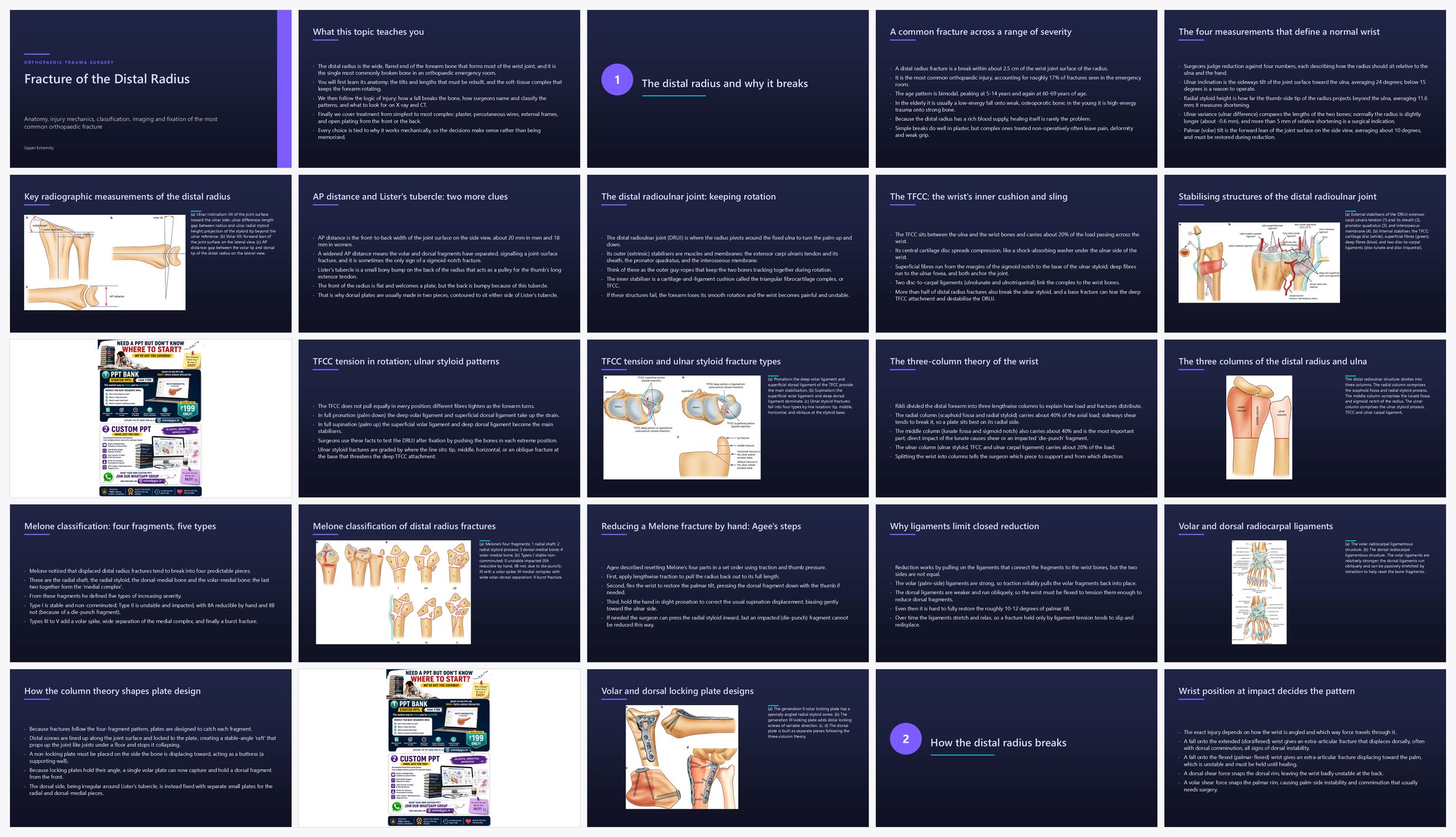 Preview of the first 25 slides of Fracture of the Distal Radius