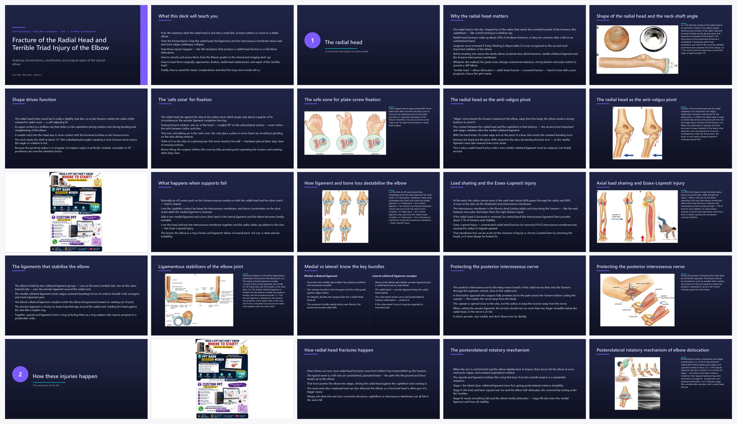 Preview of the first 25 slides of Fracture of the Radial Head and Terrible Triad Injury of t