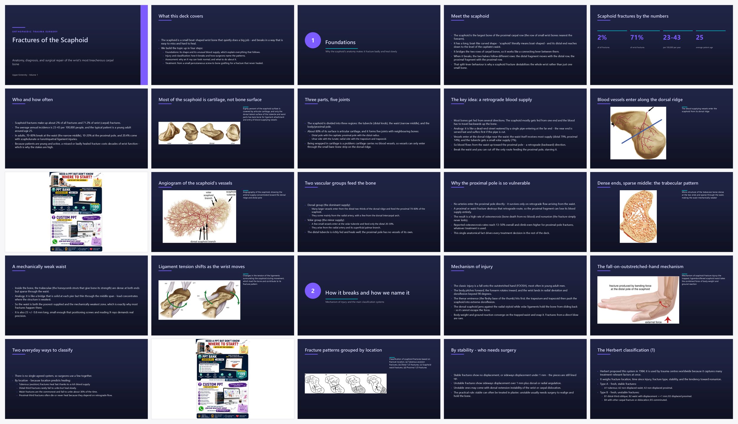 Preview of the first 25 slides of Fractures of the Scaphoid