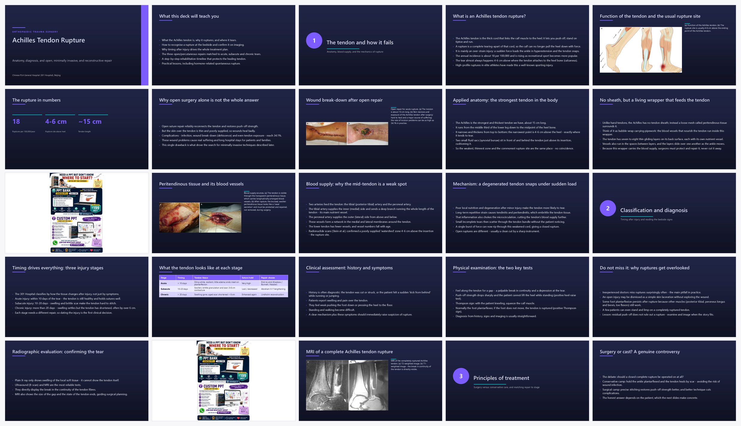 Preview of the first 25 slides of Achilles Tendon Rupture