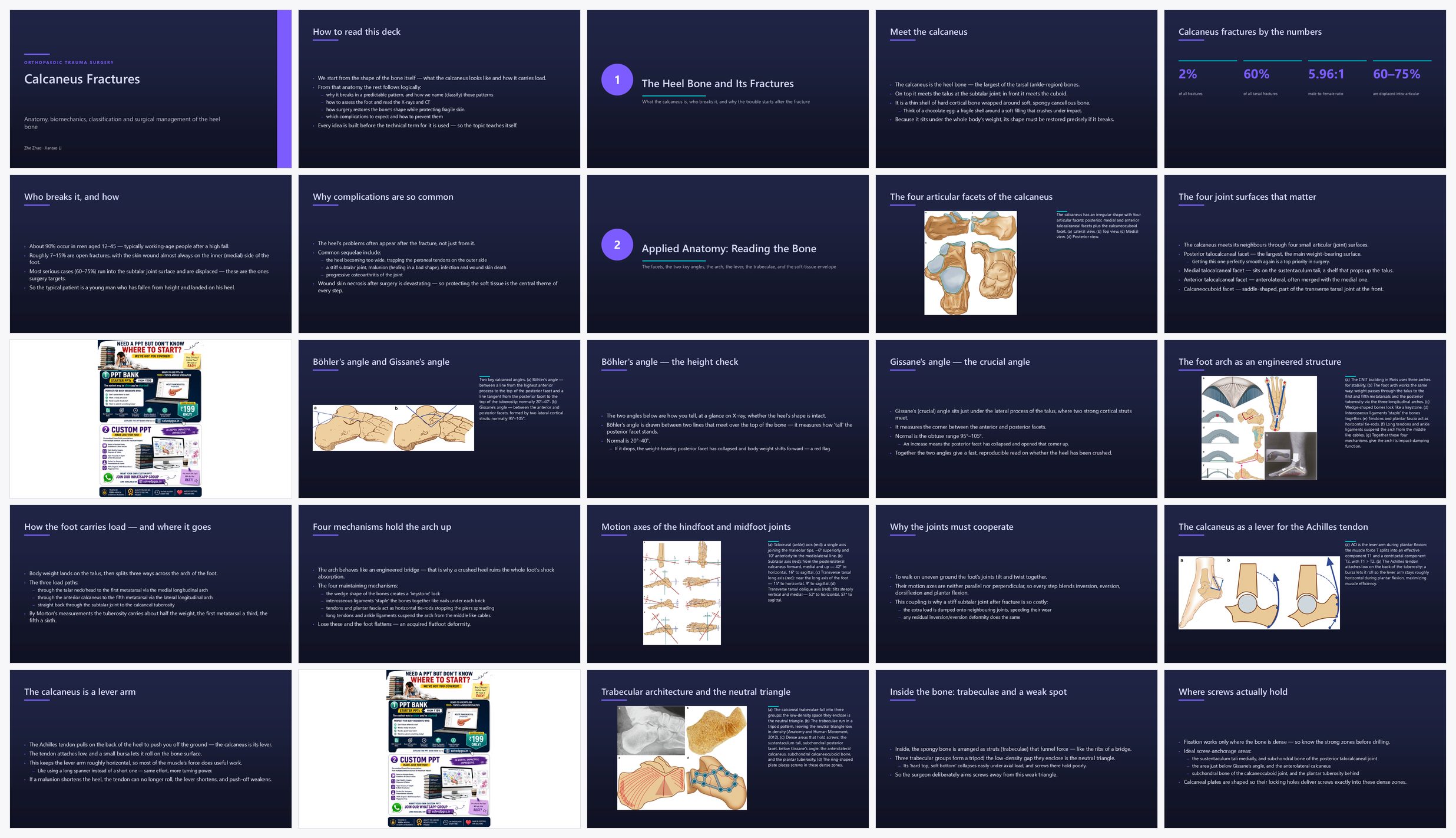 Preview of the first 25 slides of Calcaneus Fractures