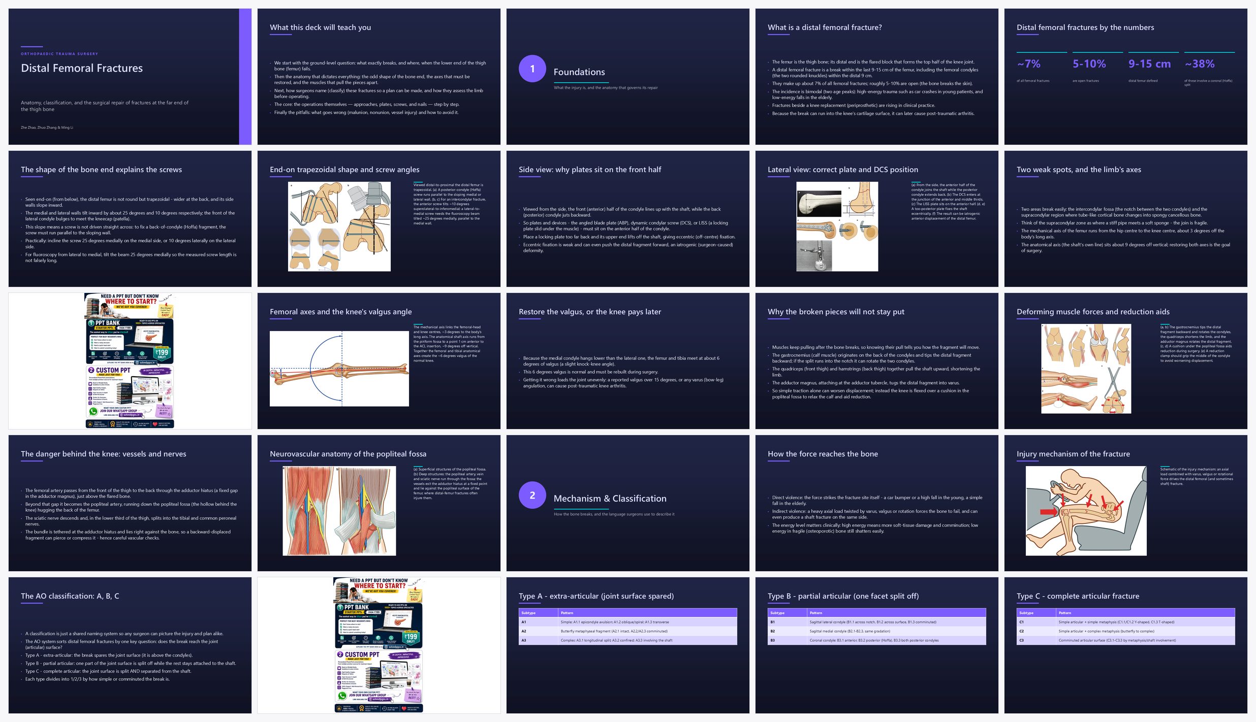 Preview of the first 25 slides of Distal Femoral Fractures