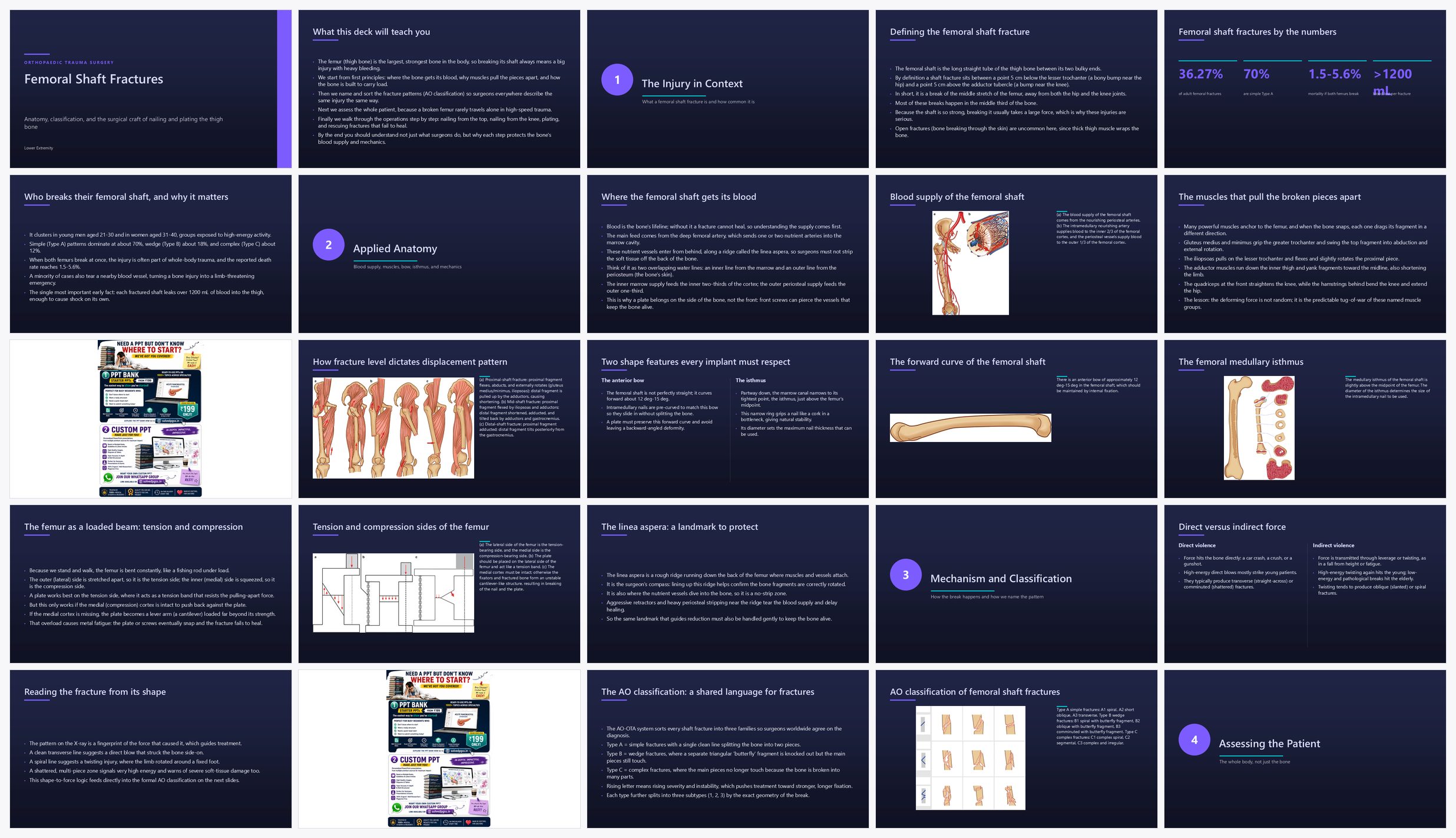 Preview of the first 25 slides of Femoral Shaft Fractures
