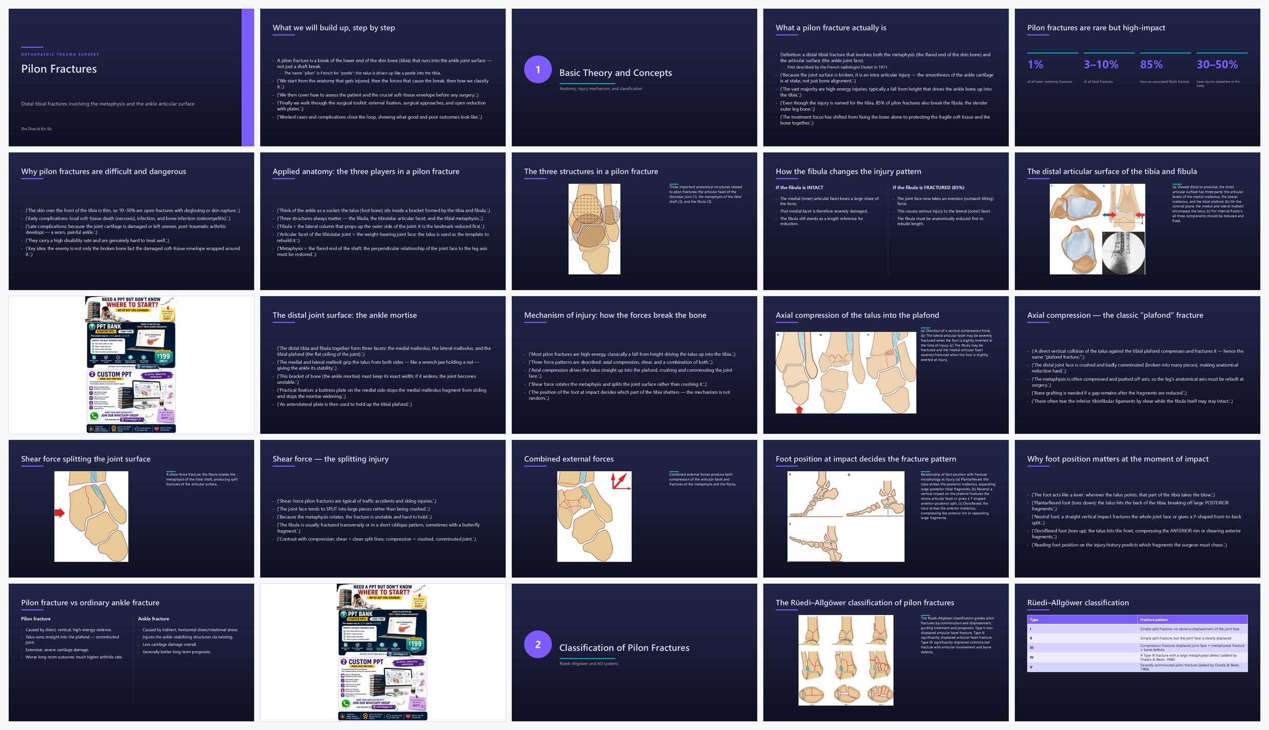 Preview of the first 25 slides of Pilon Fractures