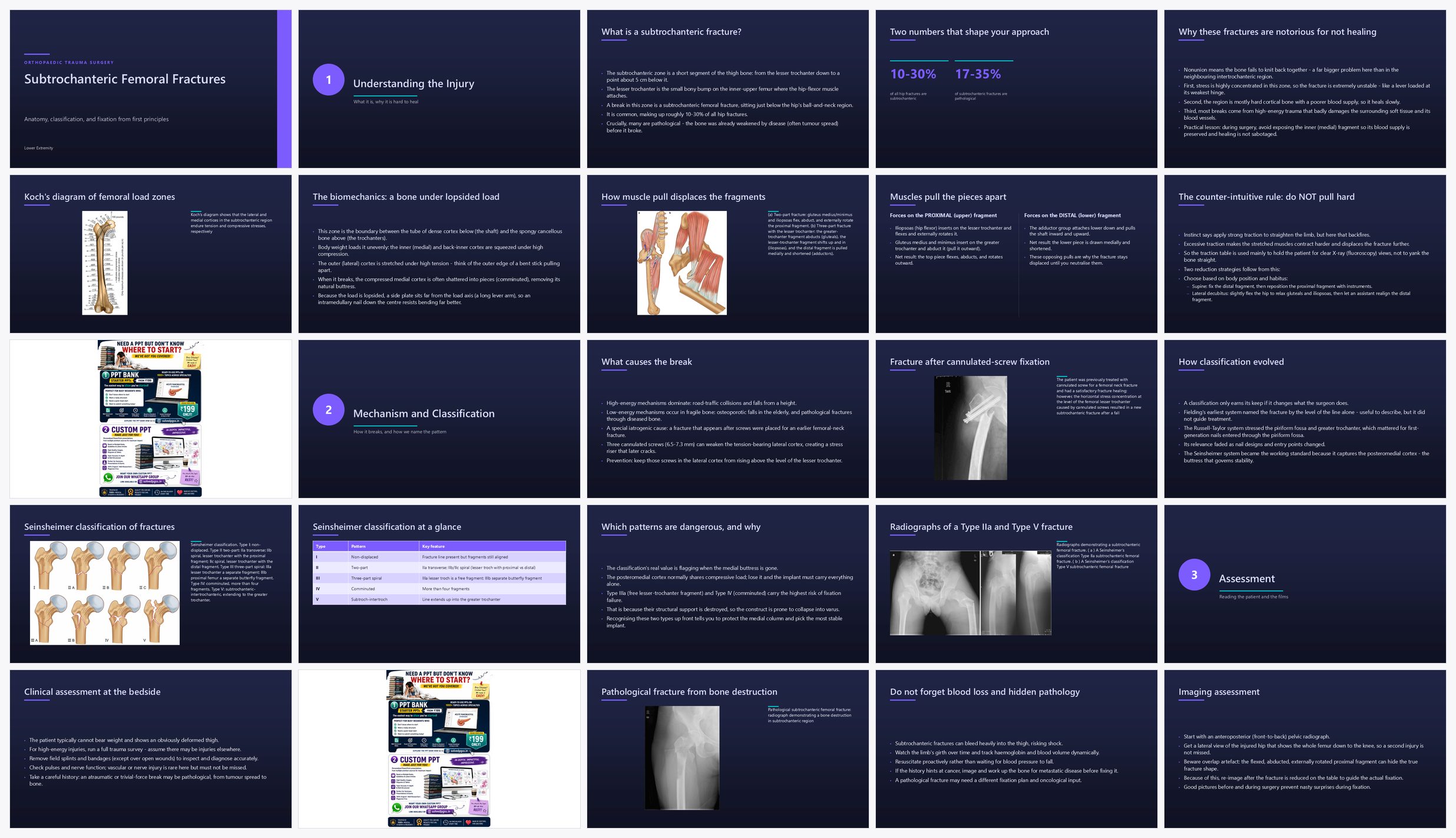 Preview of the first 25 slides of Subtrochanteric Femoral Fractures