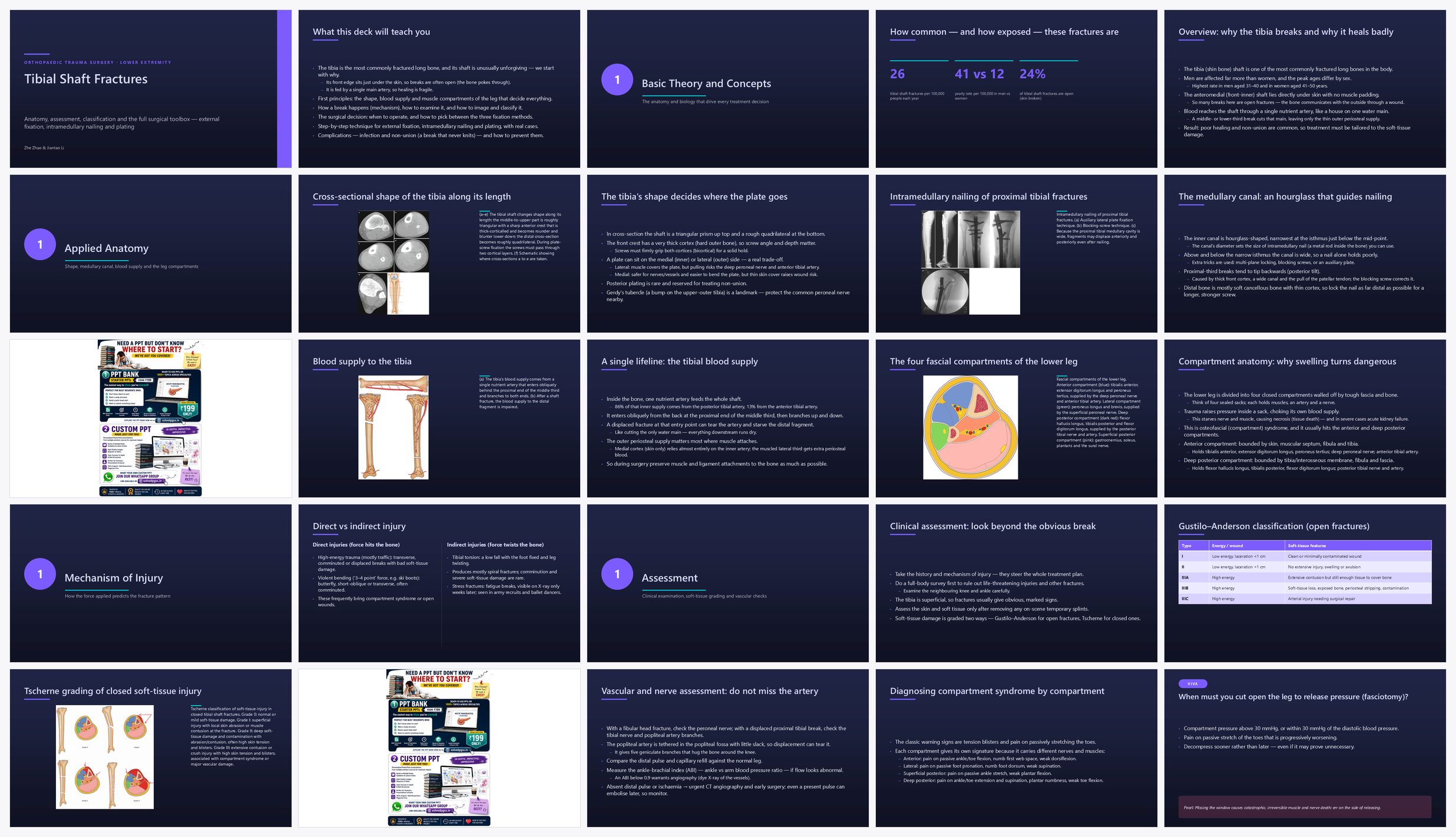 Preview of the first 25 slides of Tibial Shaft Fractures