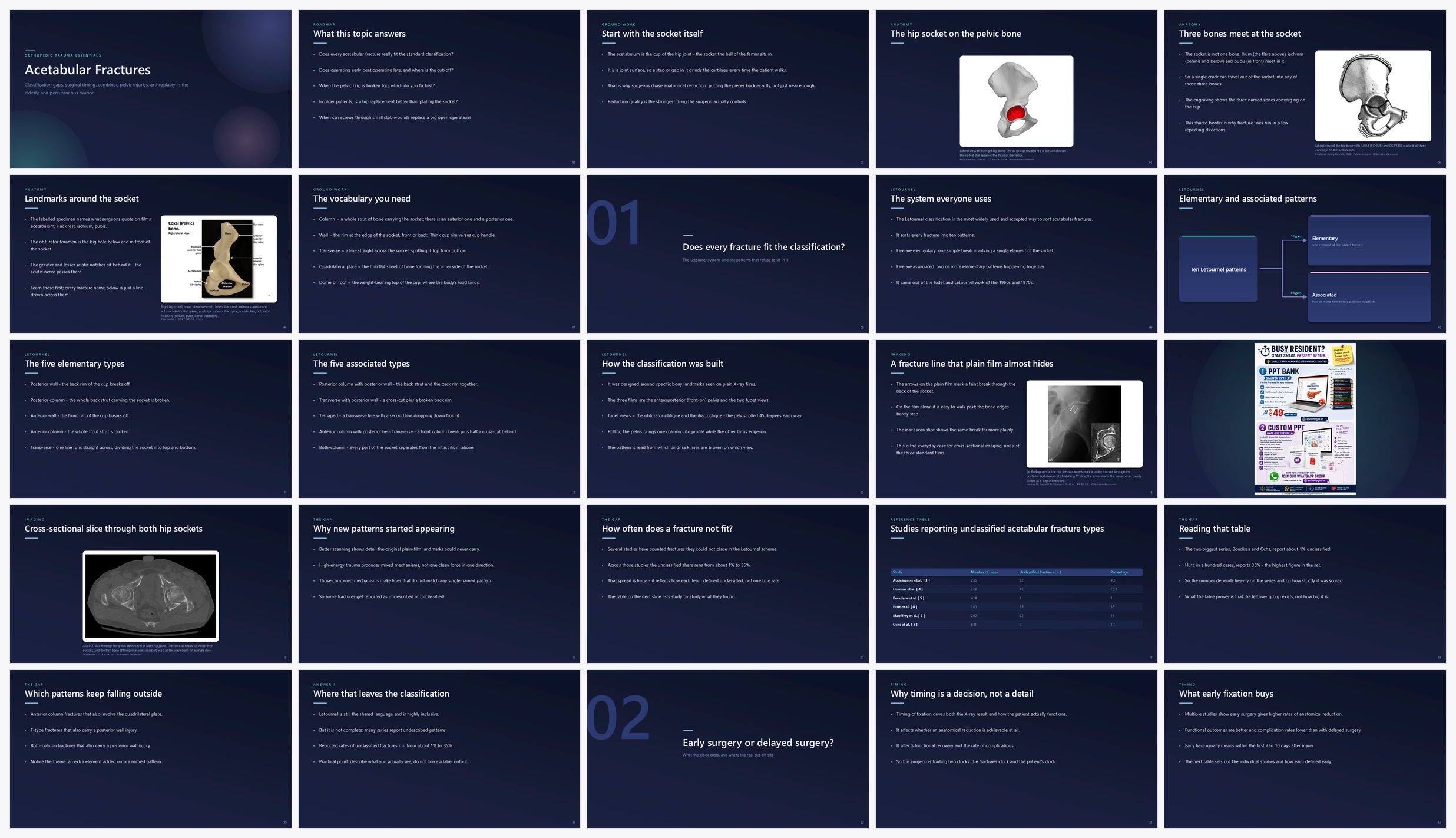 Preview of the first 25 slides of Acetabular Fractures