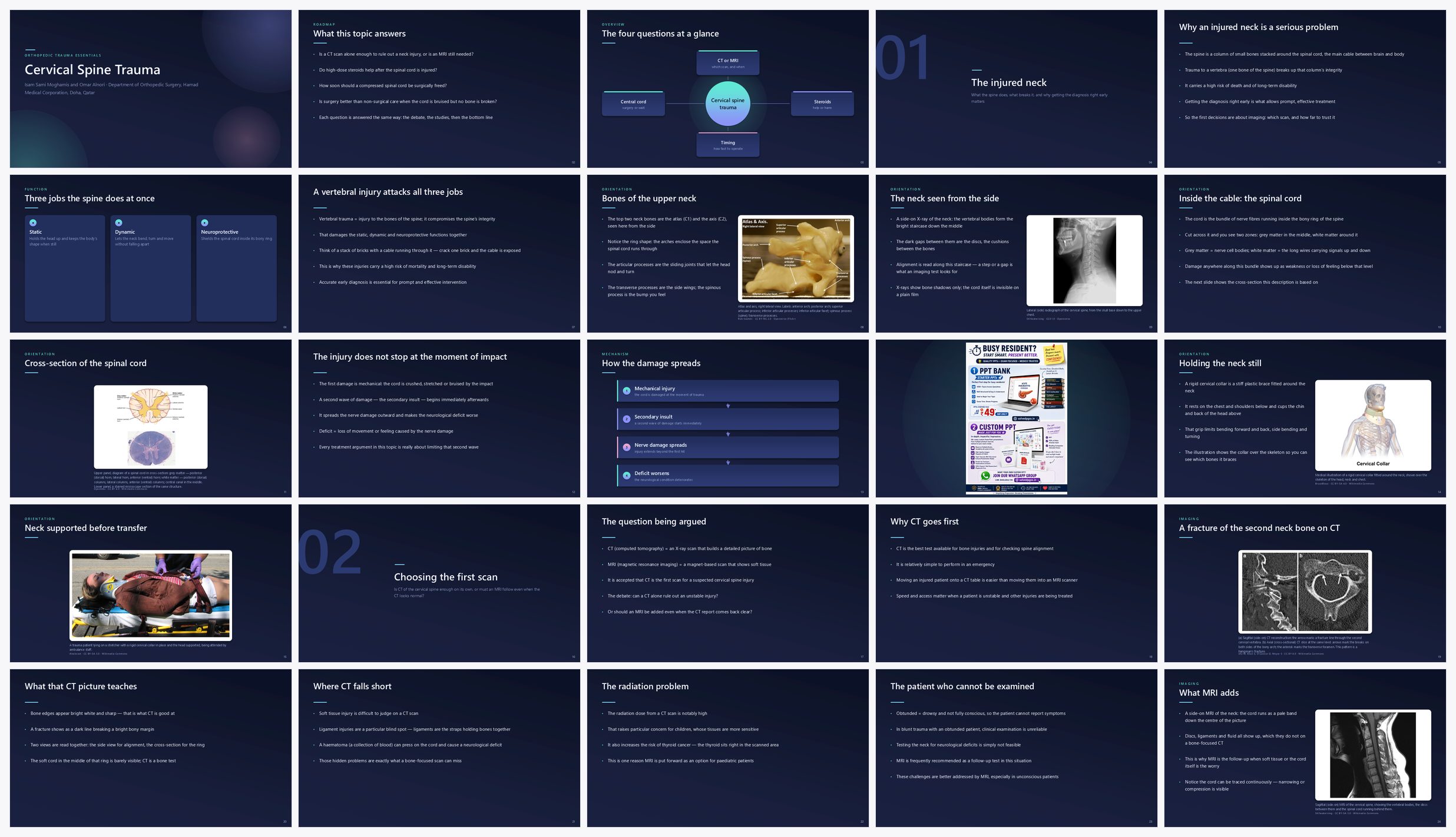 Preview of the first 25 slides of Cervical Spine Trauma