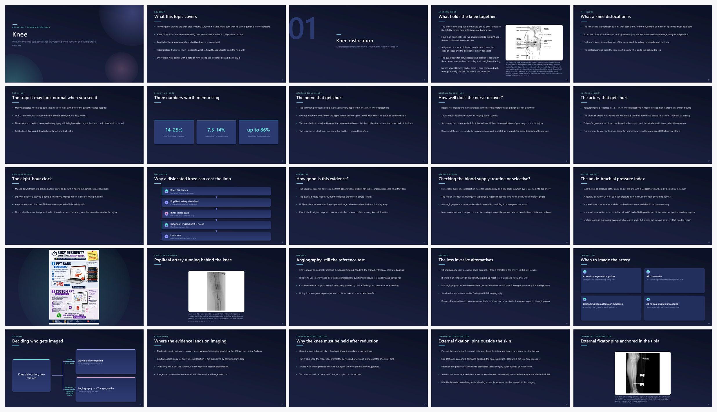 Preview of the first 25 slides of Knee