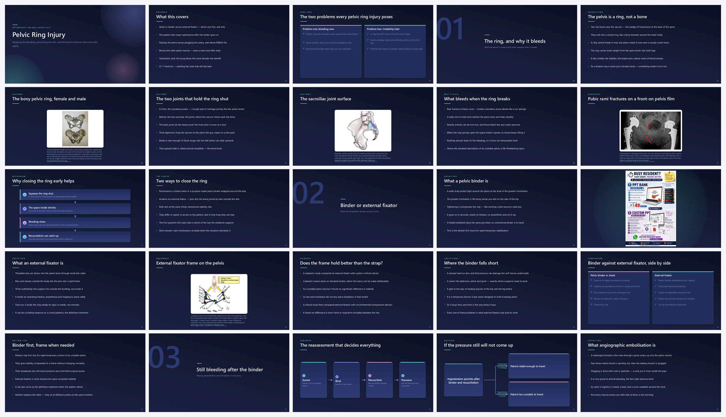 Preview of the first 25 slides of Pelvic Ring Injury