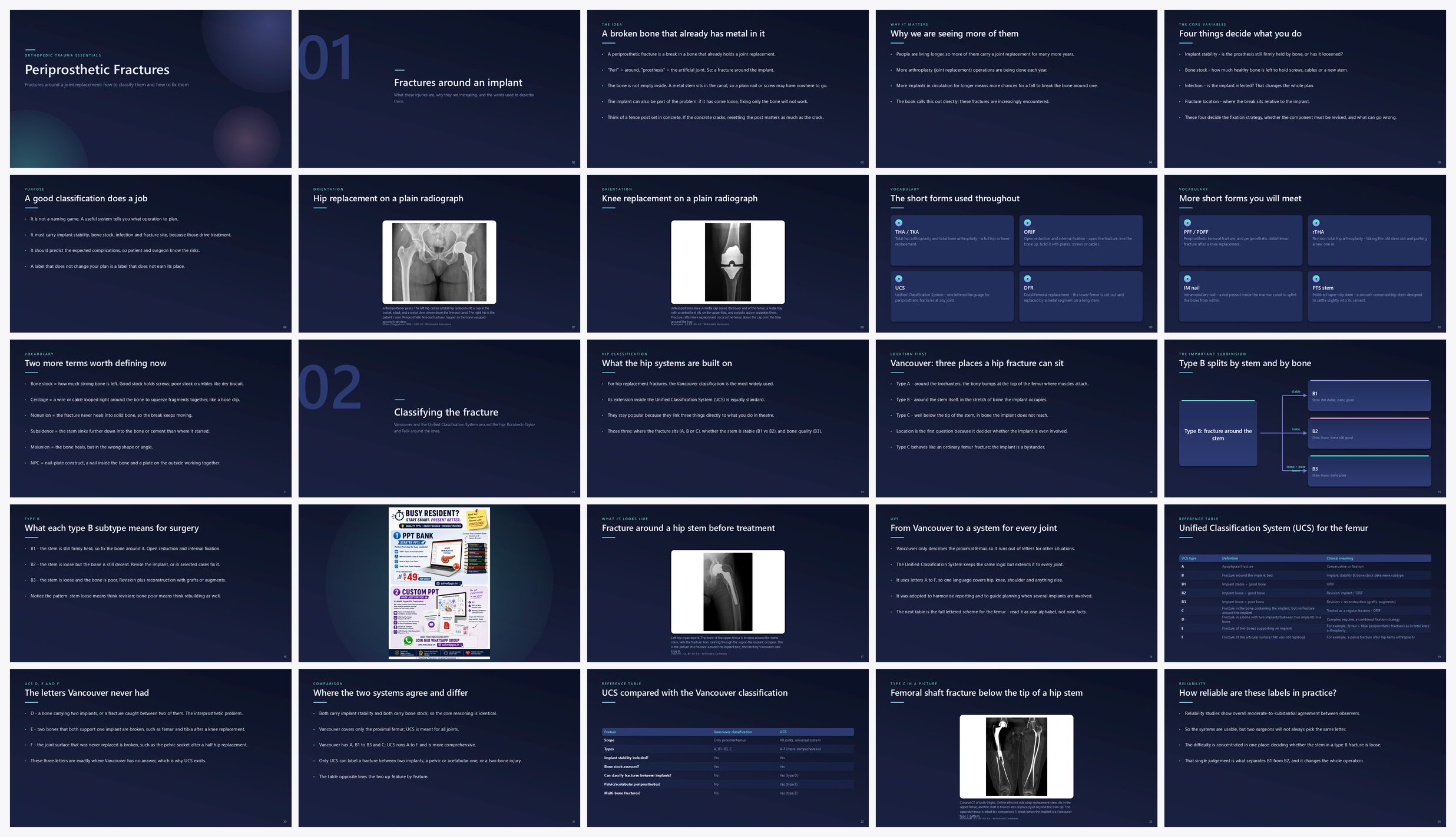 Preview of the first 25 slides of Periprosthetic Fractures
