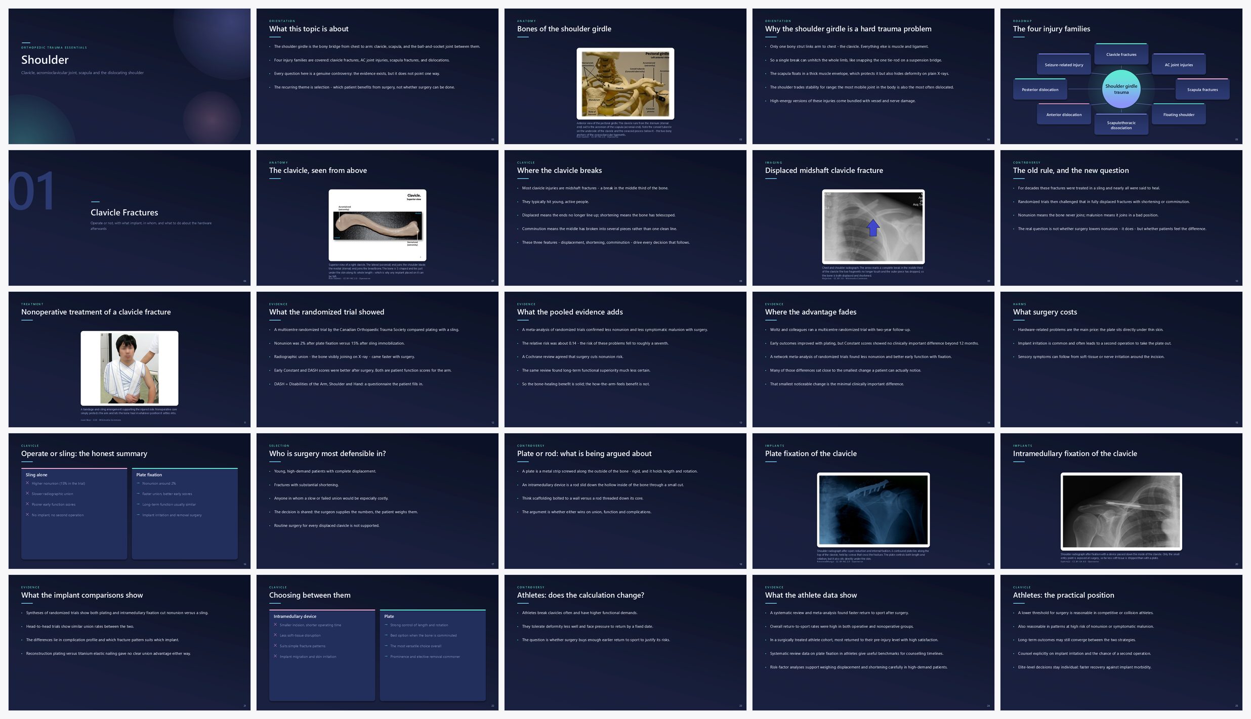 Preview of the first 25 slides of Shoulder