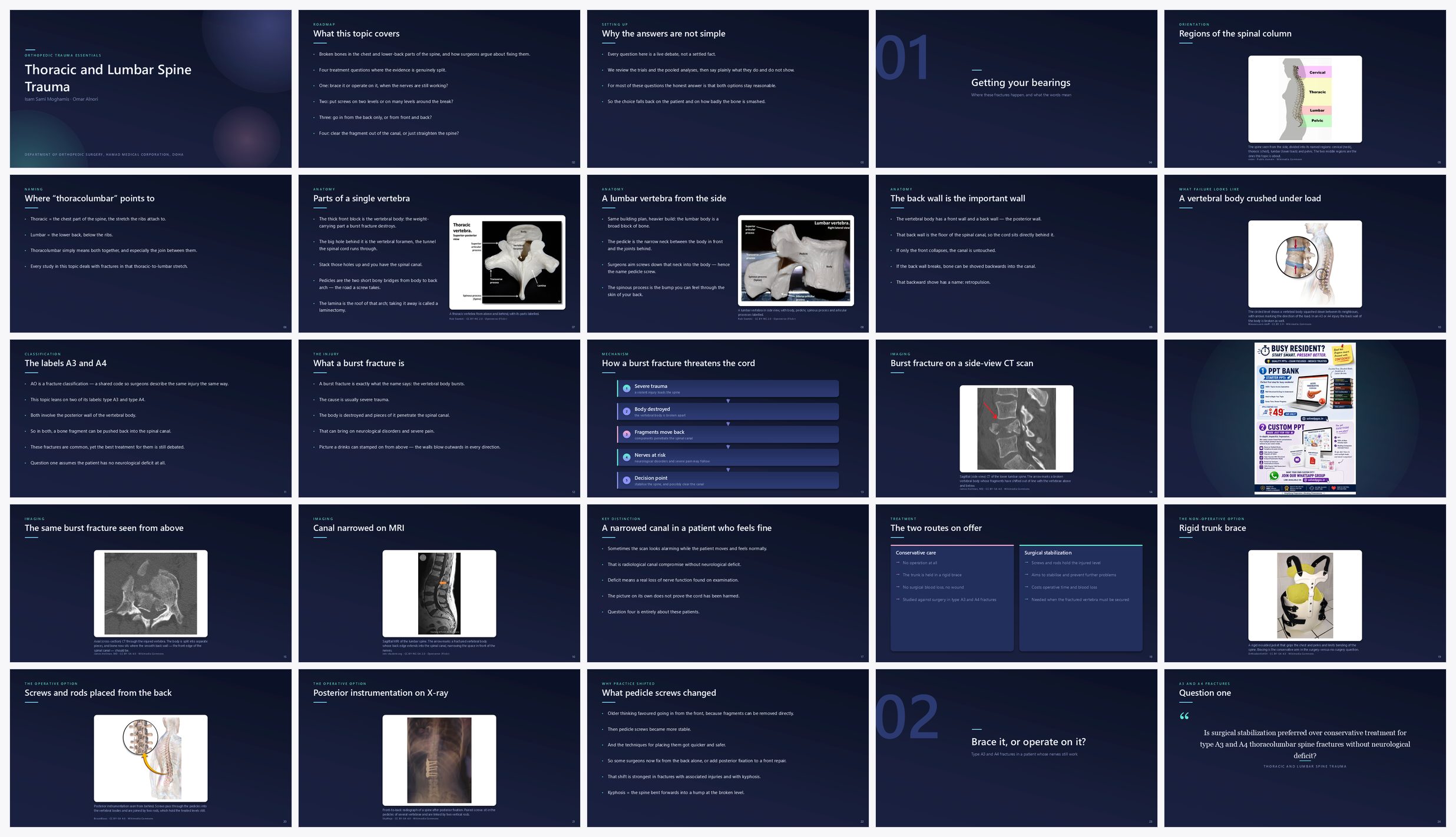 Preview of the first 25 slides of Thoracic and Lumbar Spine Trauma