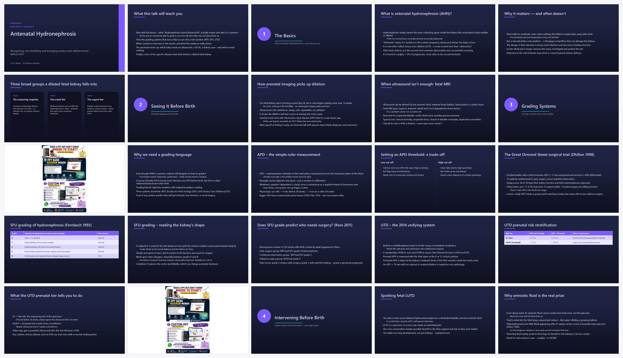 Preview of the first 25 slides of Antenatal Hydronephrosis