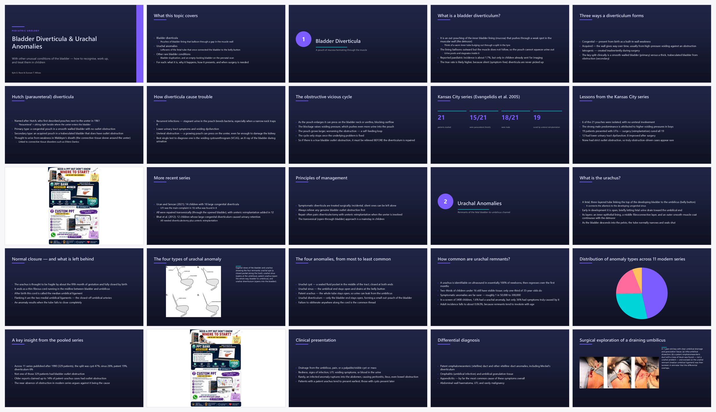 Preview of the first 25 slides of Bladder Diverticula Urachal Anomalies and Other Unusual Co