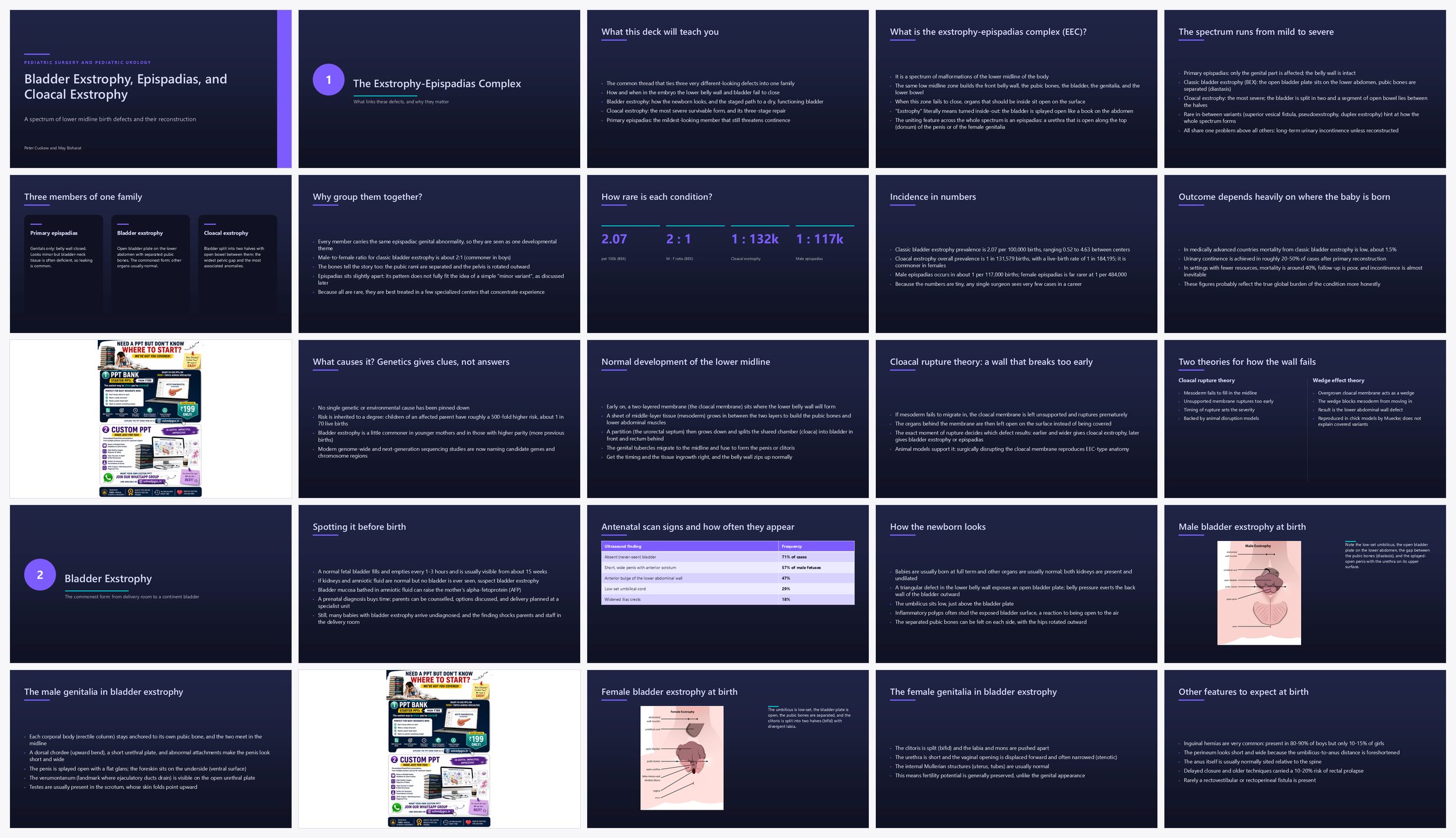 Preview of the first 25 slides of Bladder Exstrophy Epispadias and Cloacal Exstrophy